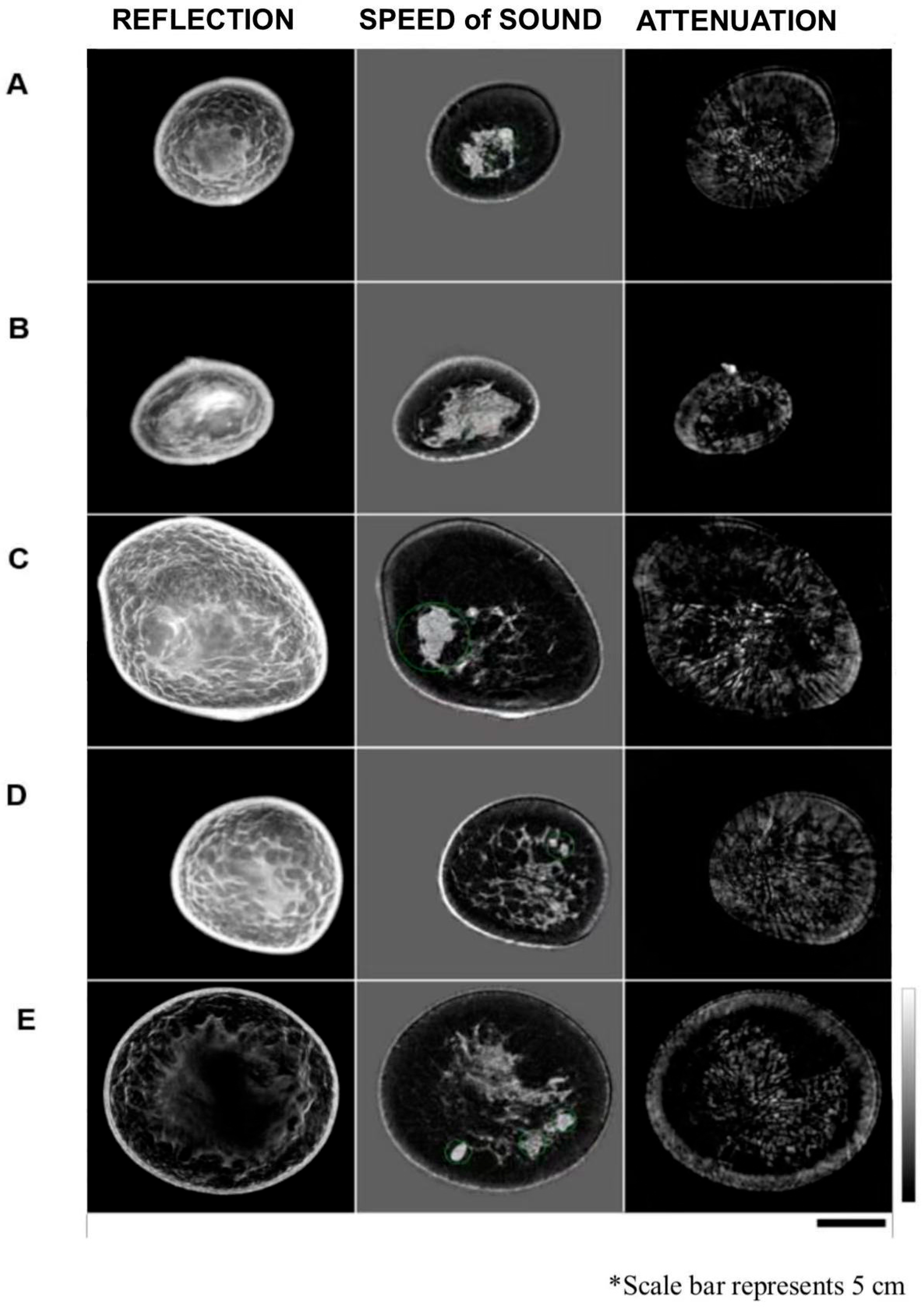 Tomography 11 00111 g002