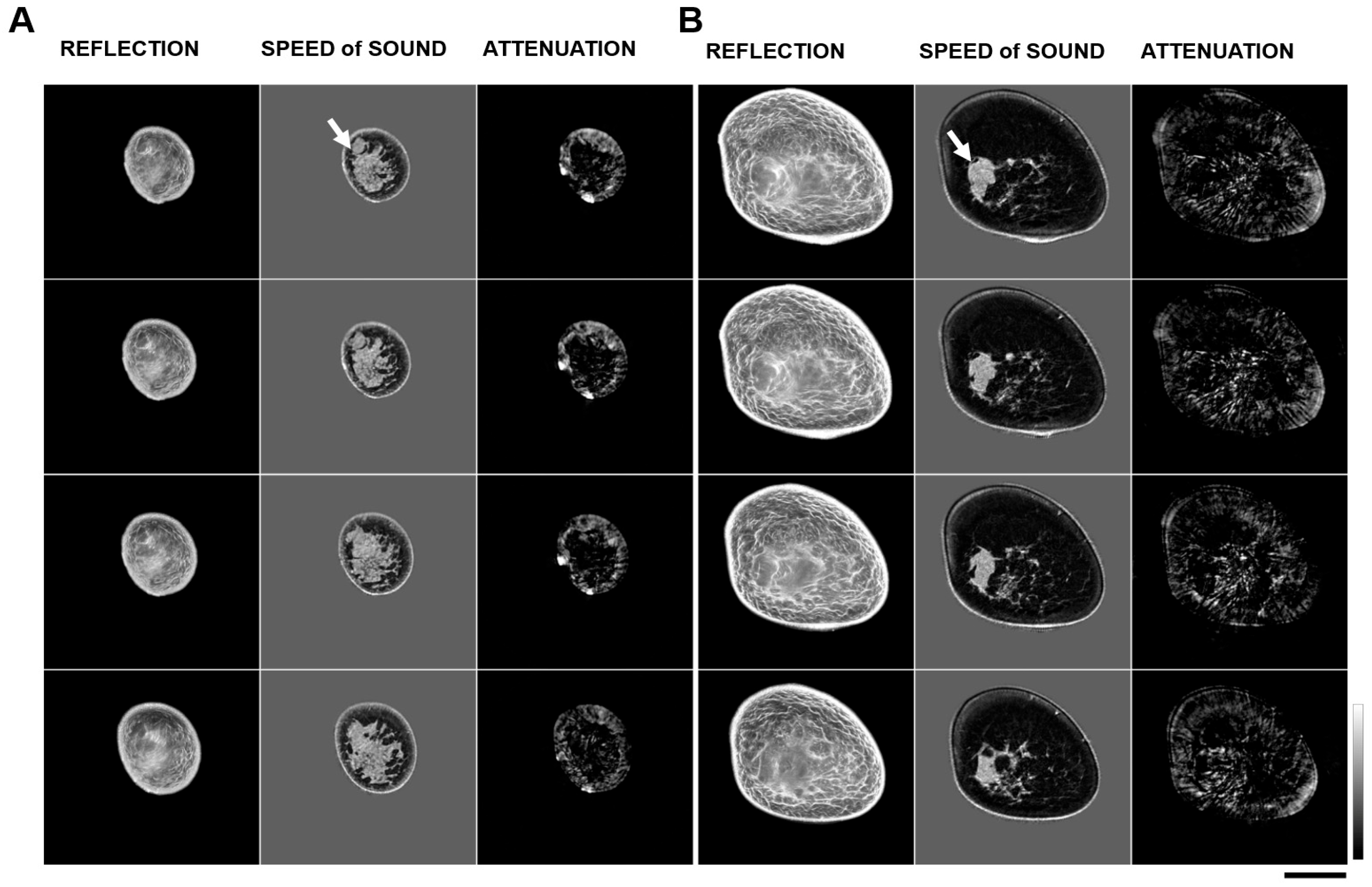 Tomography 11 00111 g003