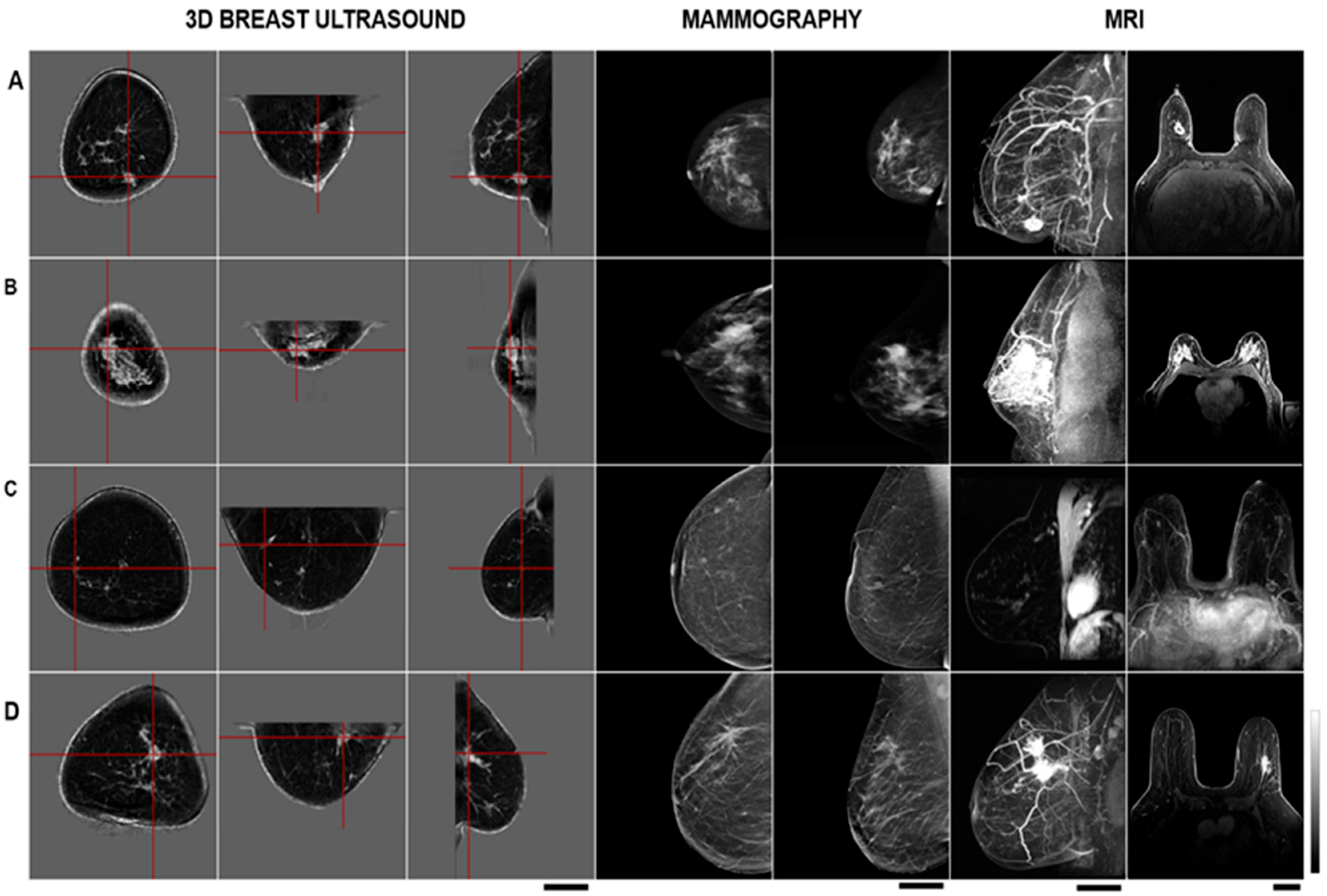 Tomography 11 00111 g004