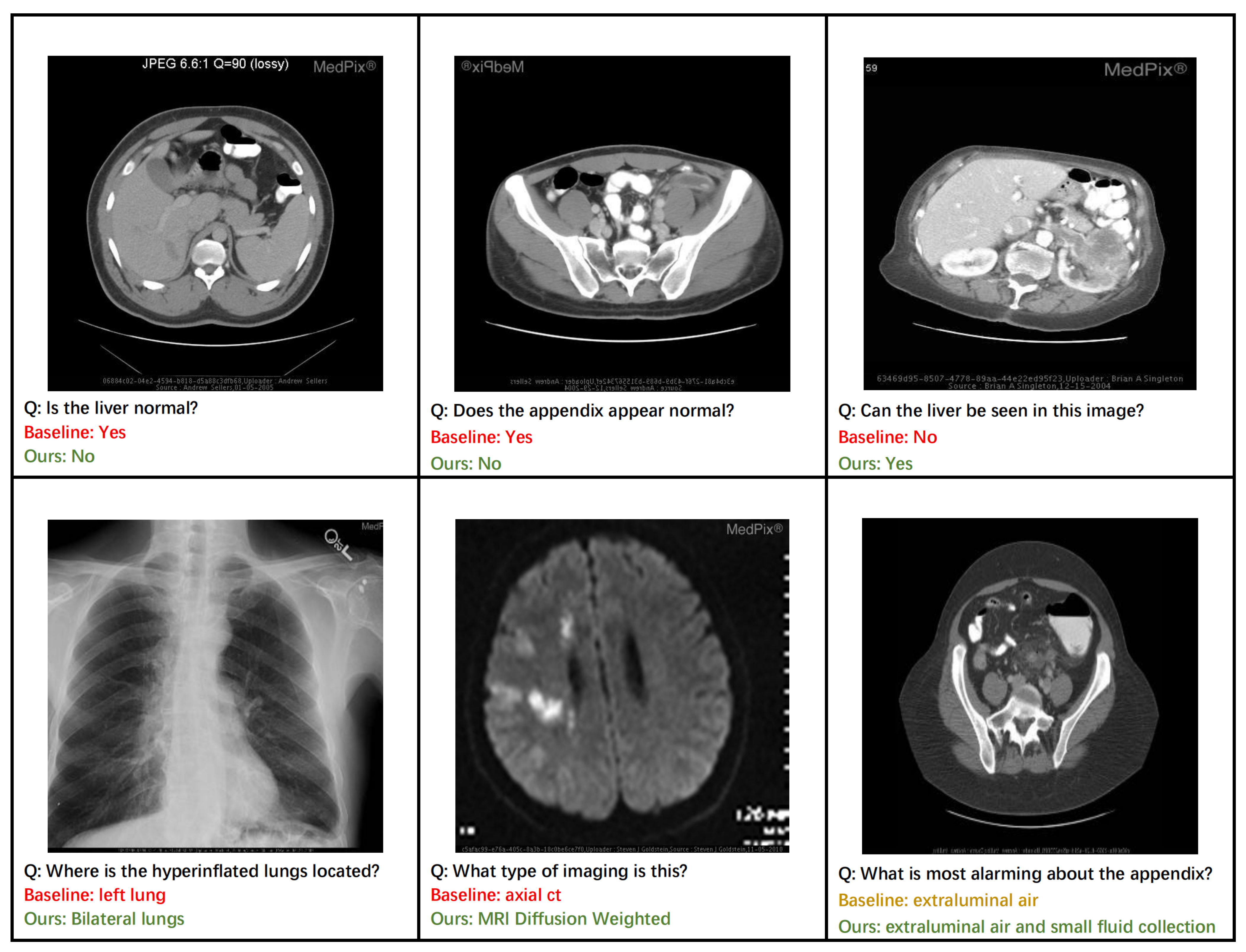 Tomography 11 00115 g006 Tomography 11 00115 g006