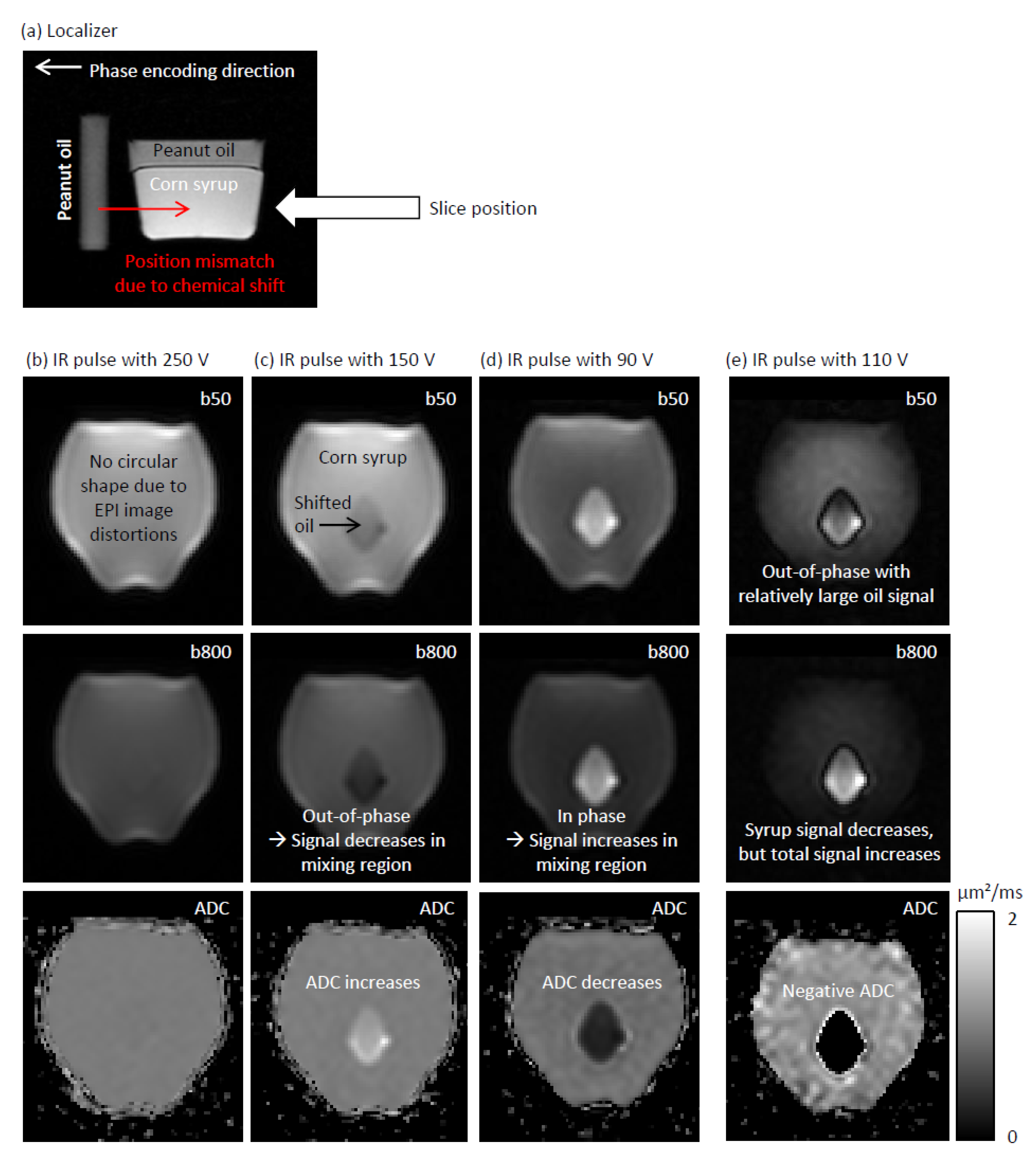 Tomography 12 00011 g003 Tomography 12 00011 g003