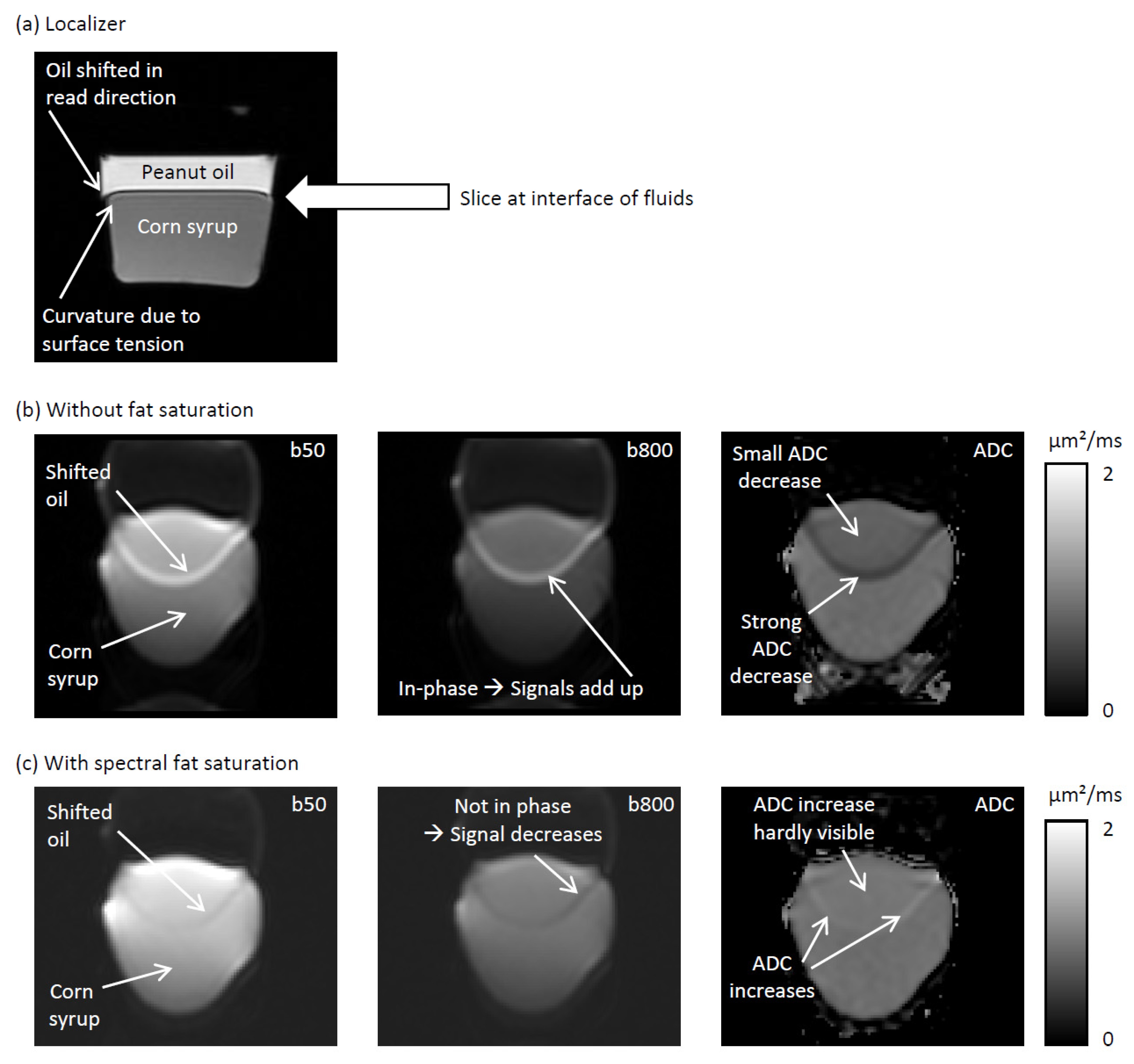 Tomography 12 00011 g004 Tomography 12 00011 g004