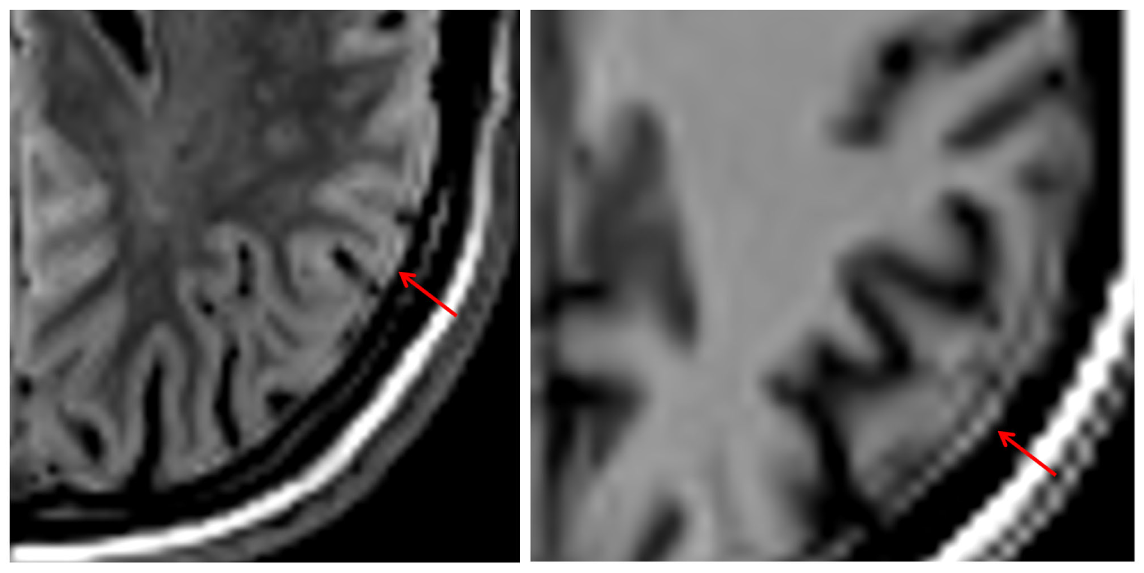 Tomography 12 00013 g011 Tomography 12 00013 g011