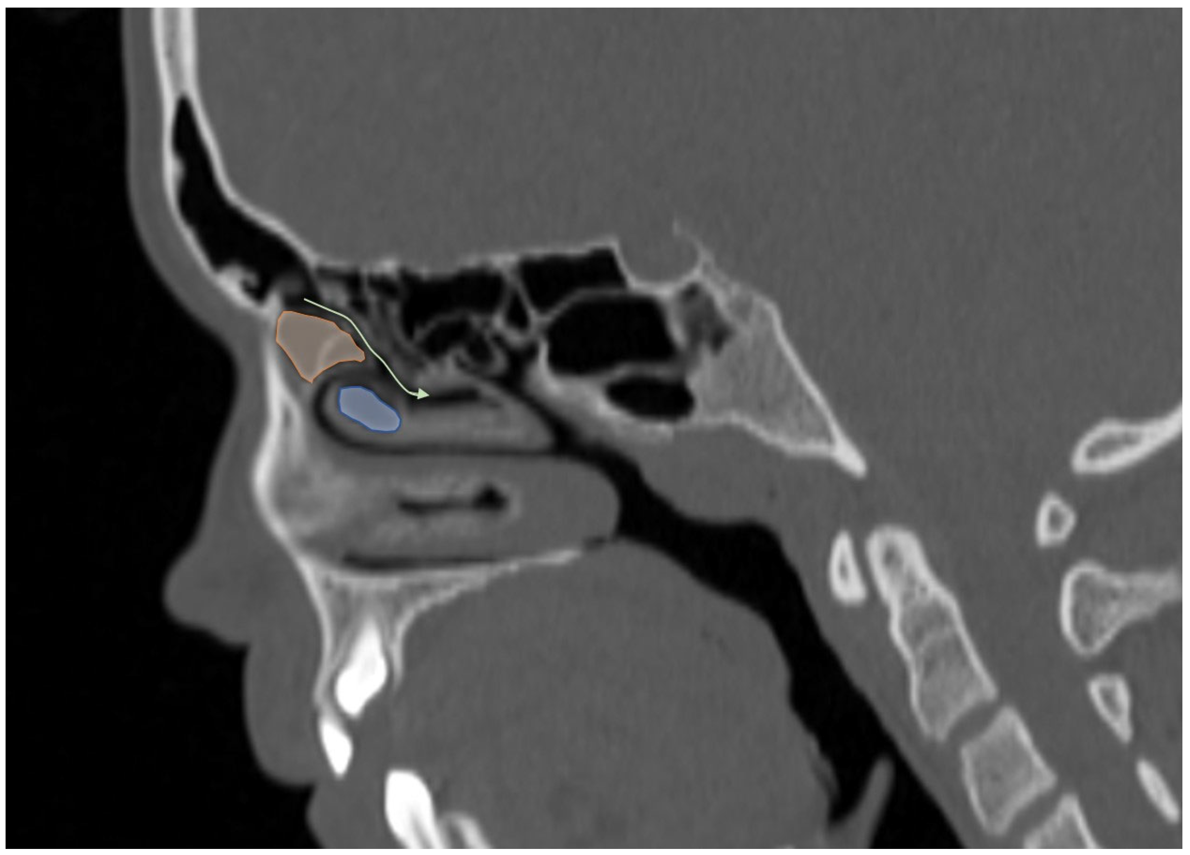 Tomography 12 00015 g004