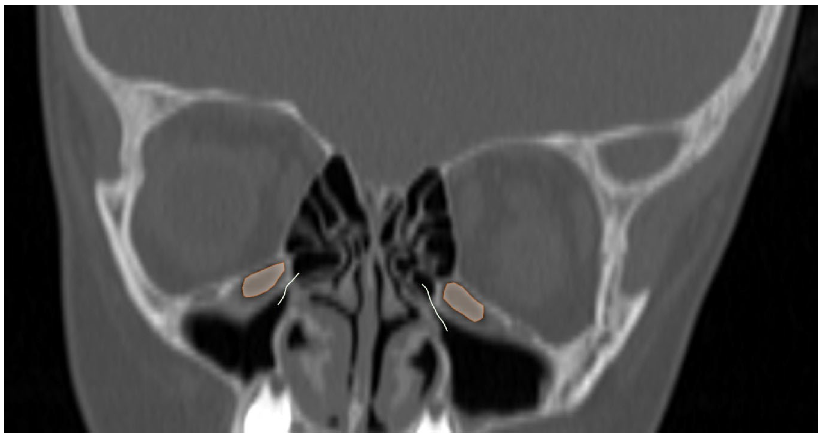 Tomography 12 00015 g005