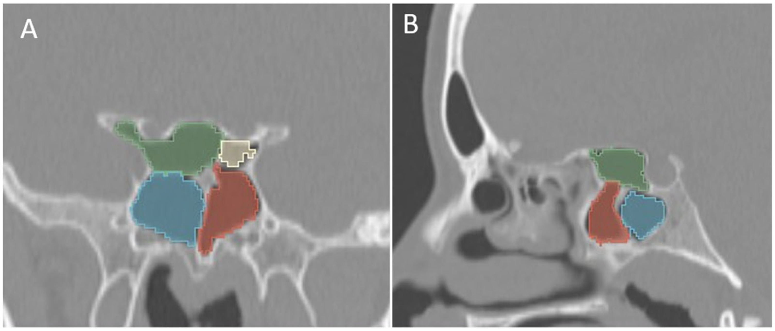 Tomography 12 00015 g006
