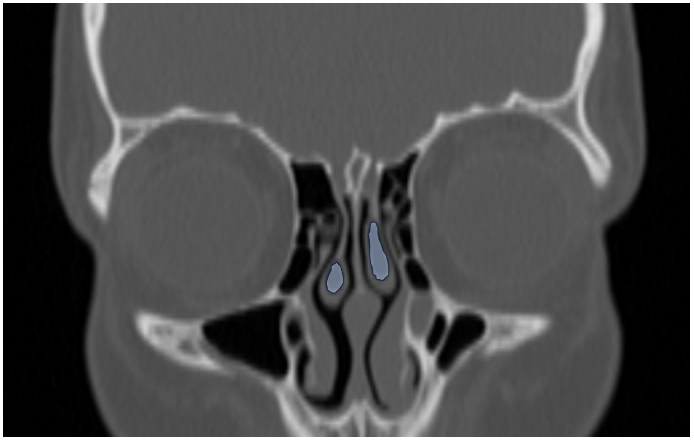 Tomography 12 00015 g007