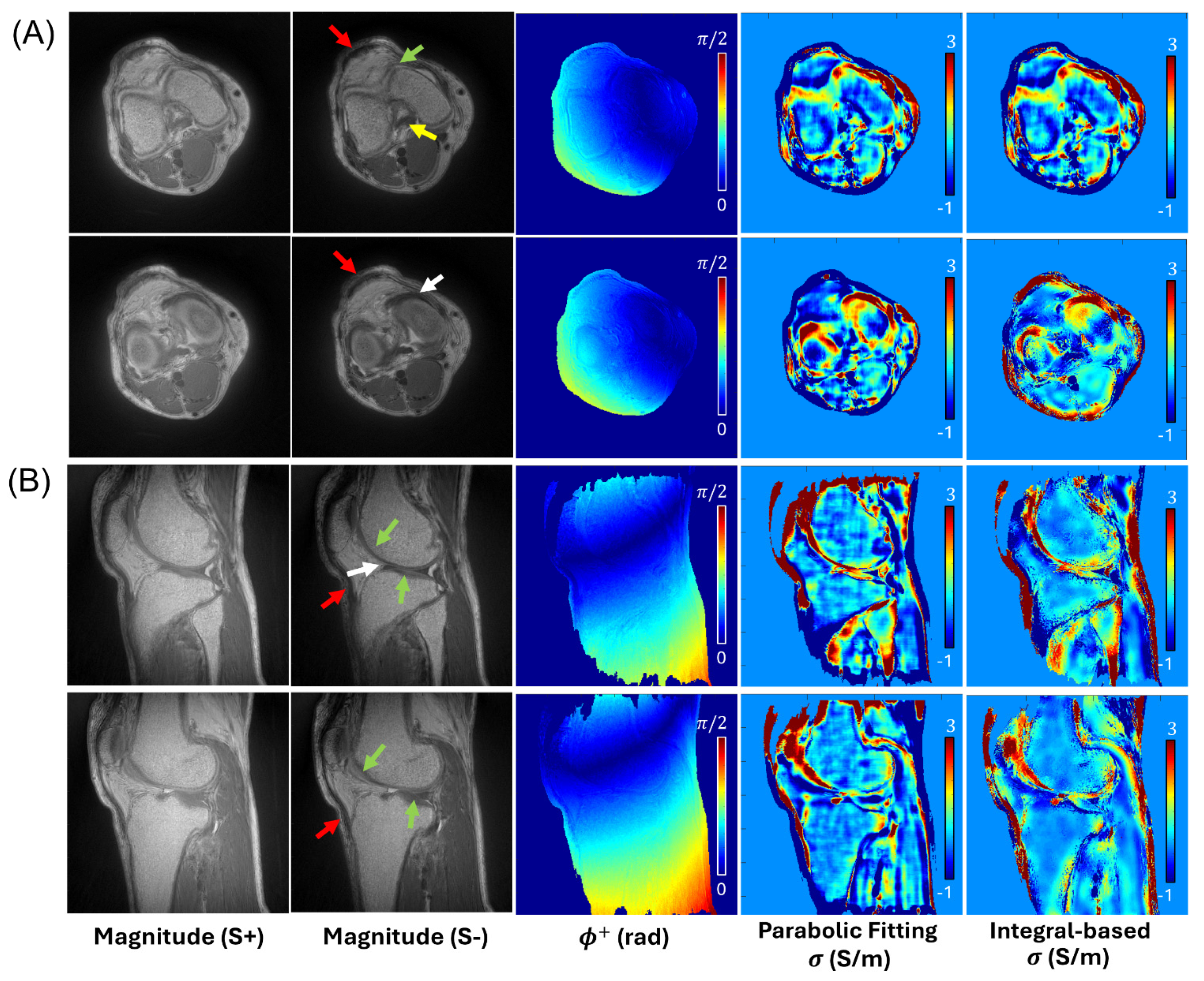 Tomography 12 00018 g003 Tomography 12 00018 g003