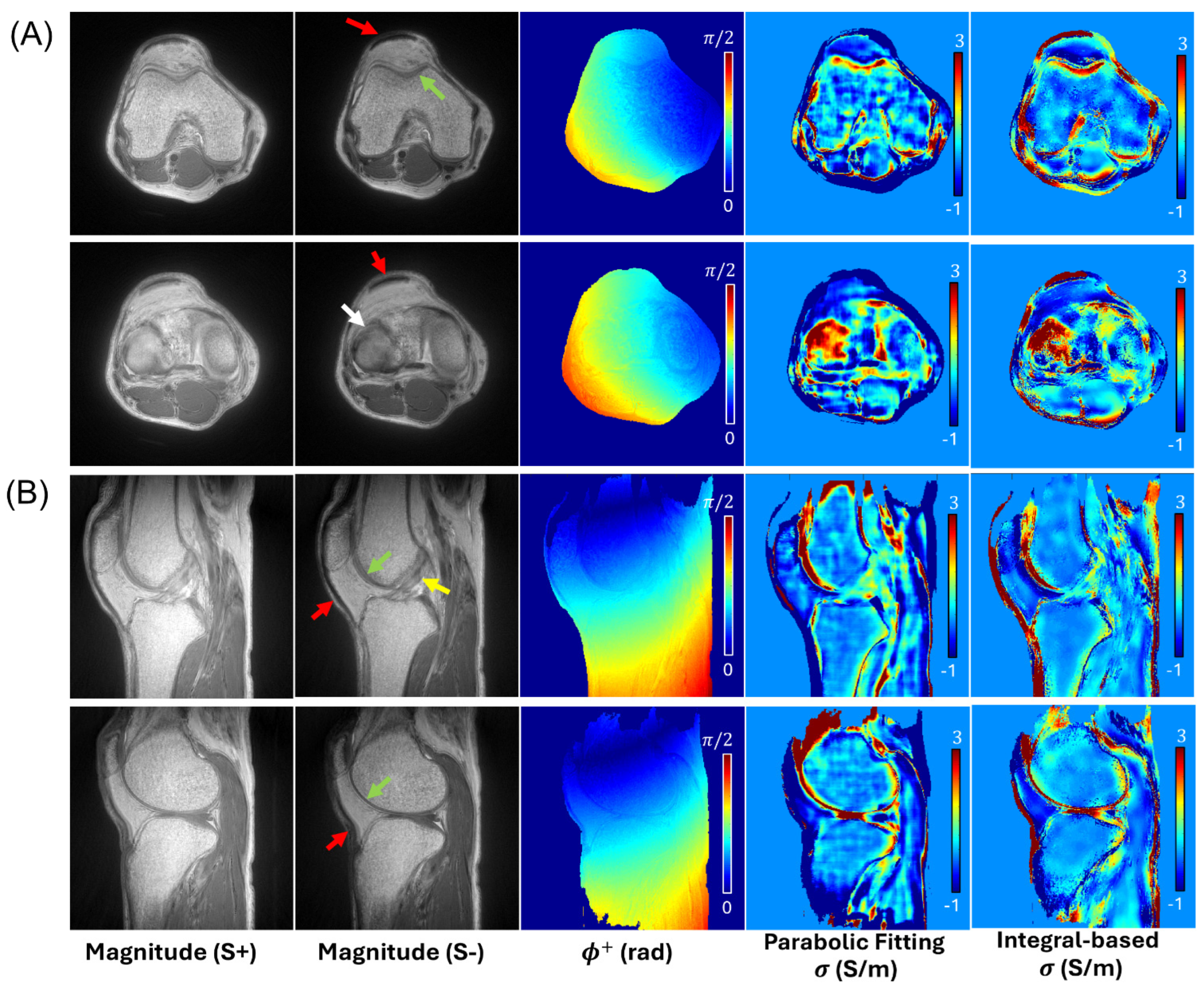 Tomography 12 00018 g004 Tomography 12 00018 g004