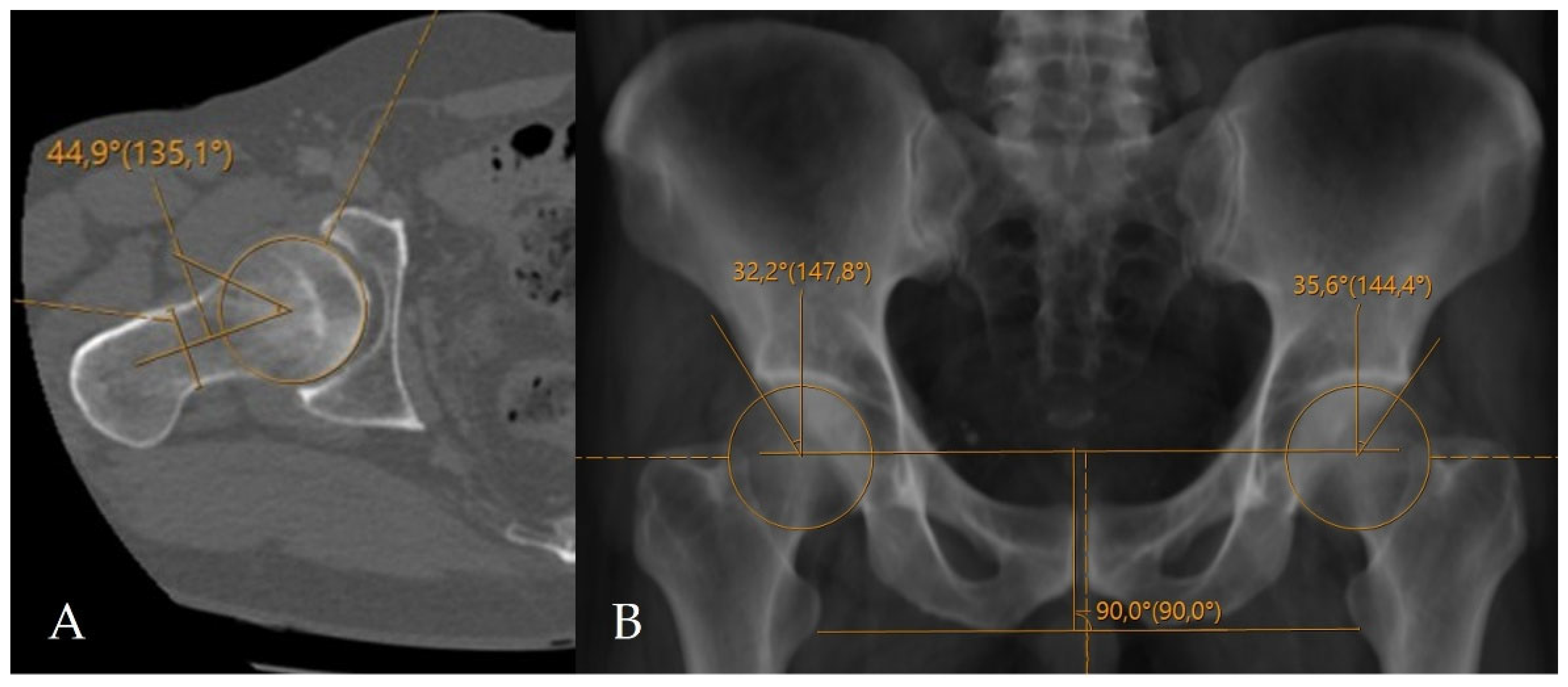 Tomography 12 00019 g002