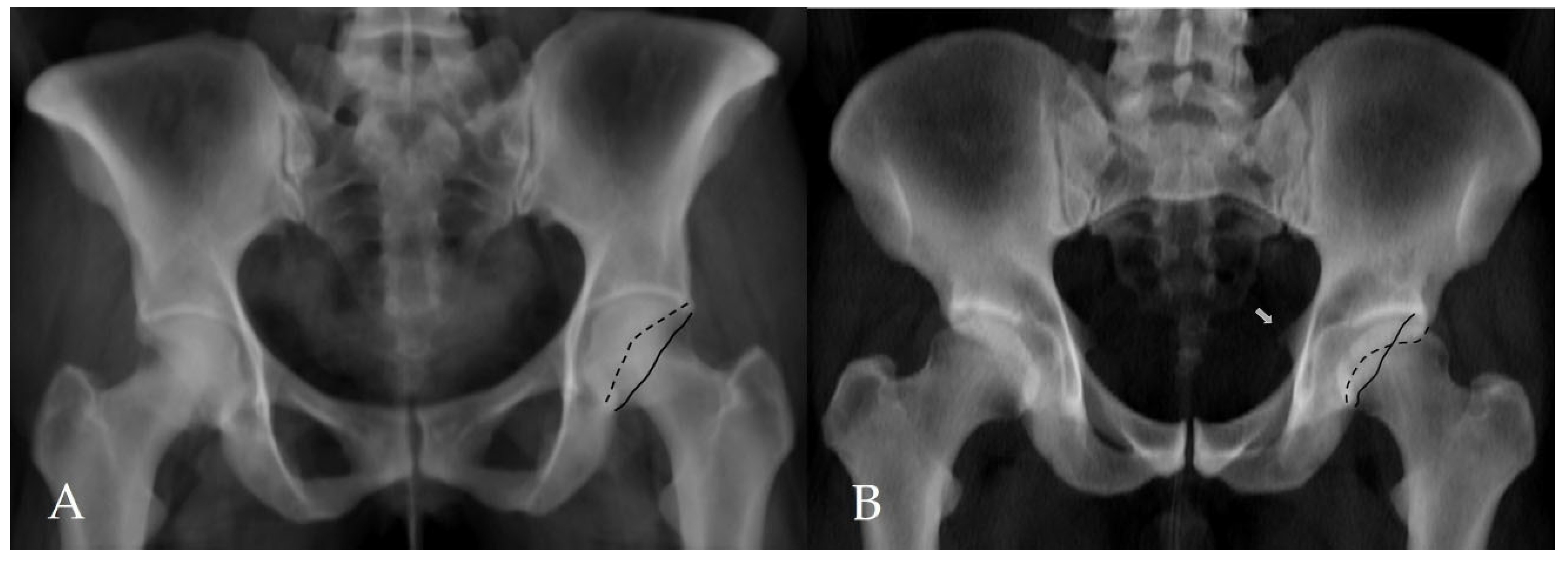 Tomography 12 00019 g003