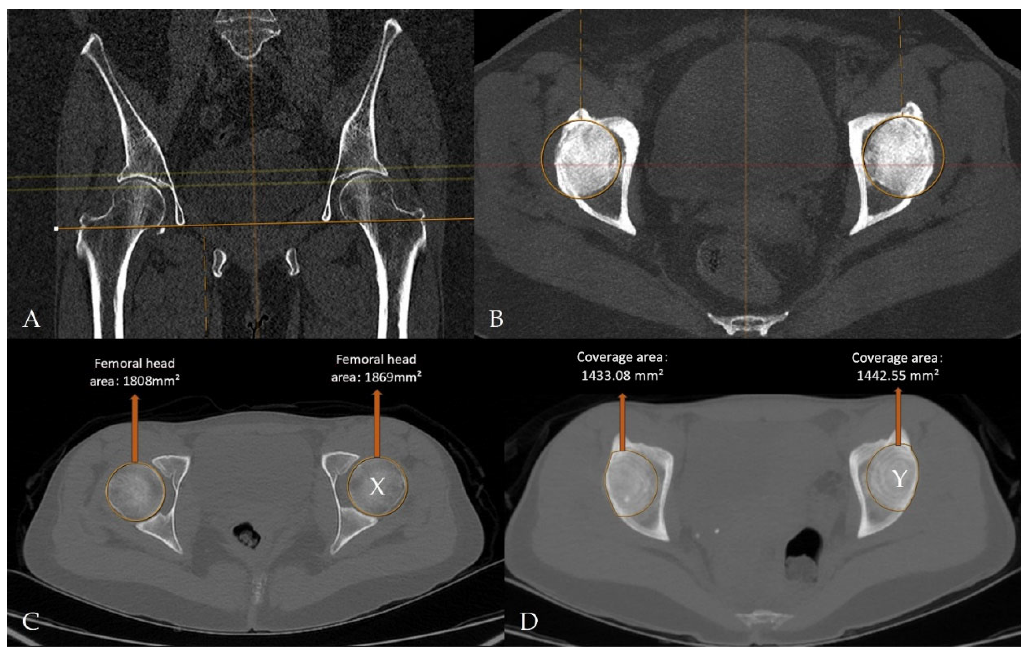 Tomography 12 00019 g005