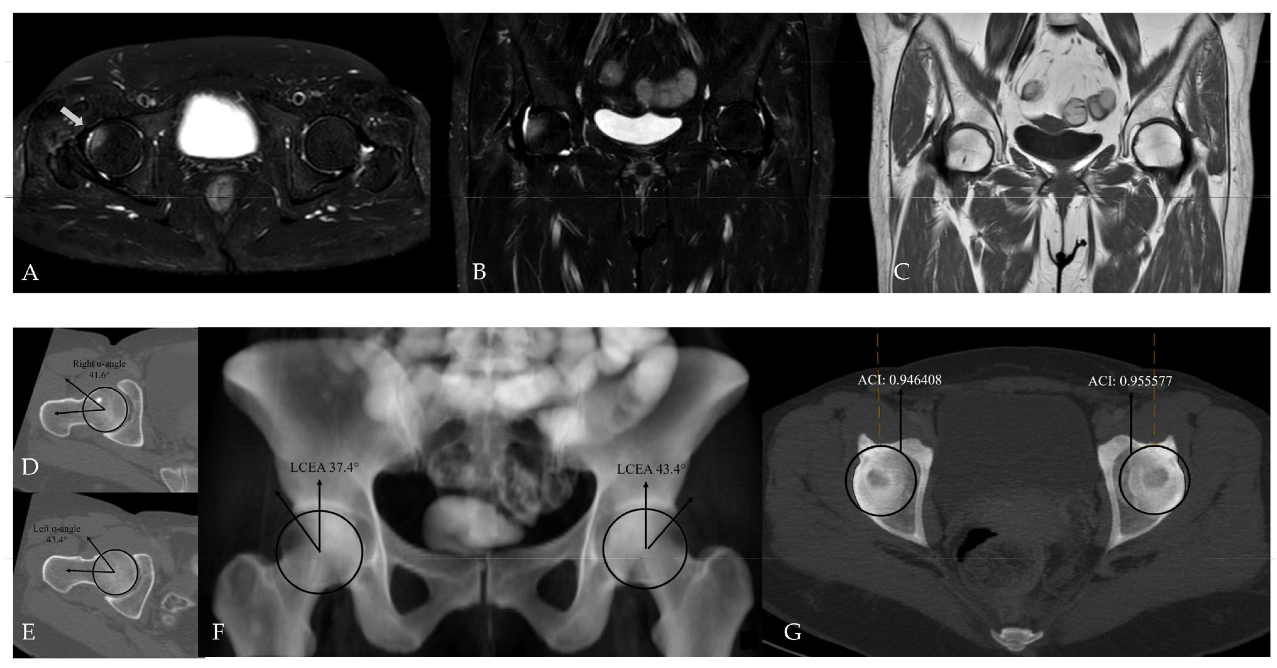 Tomography 12 00019 g007