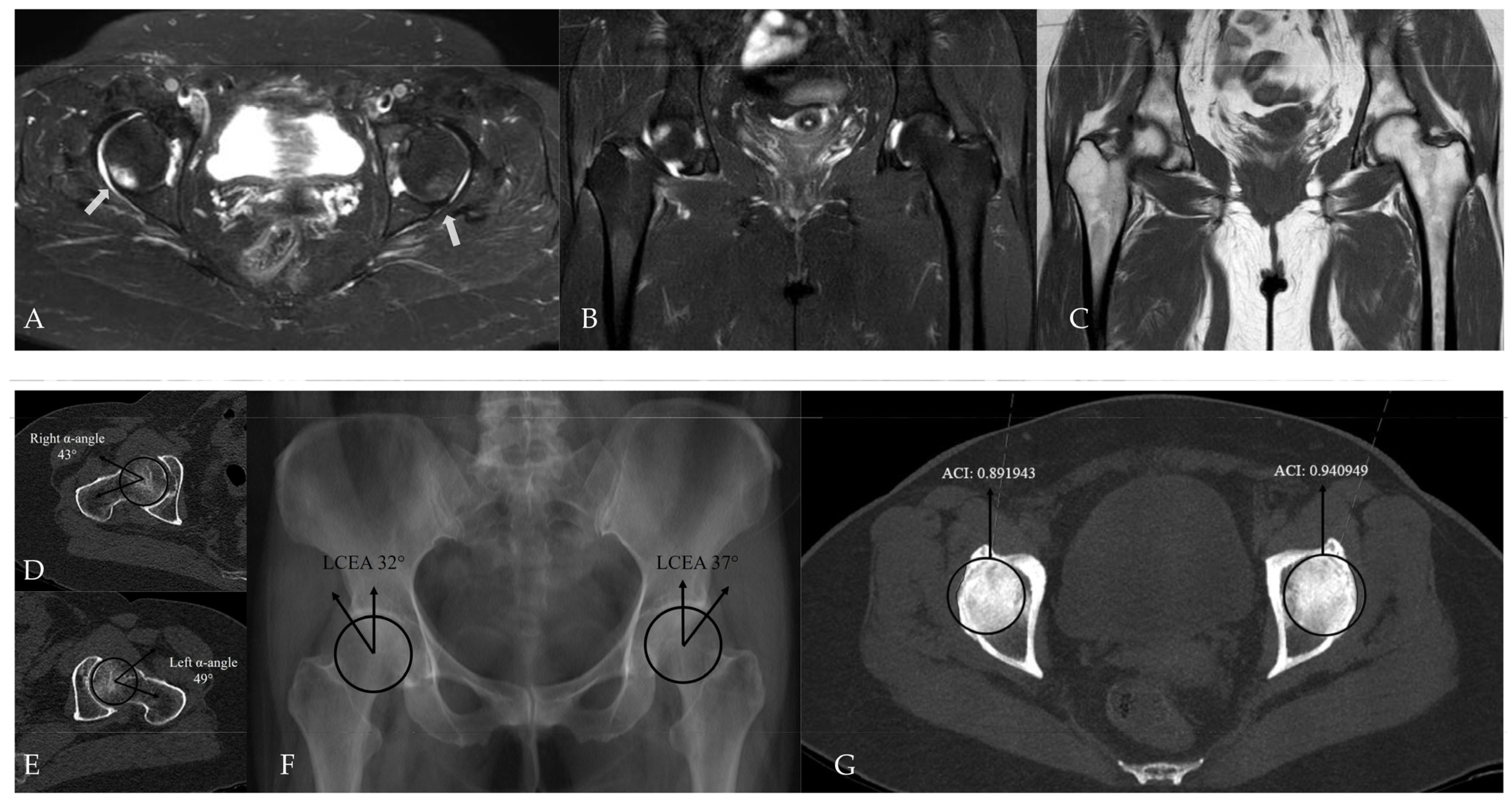 Tomography 12 00019 g008