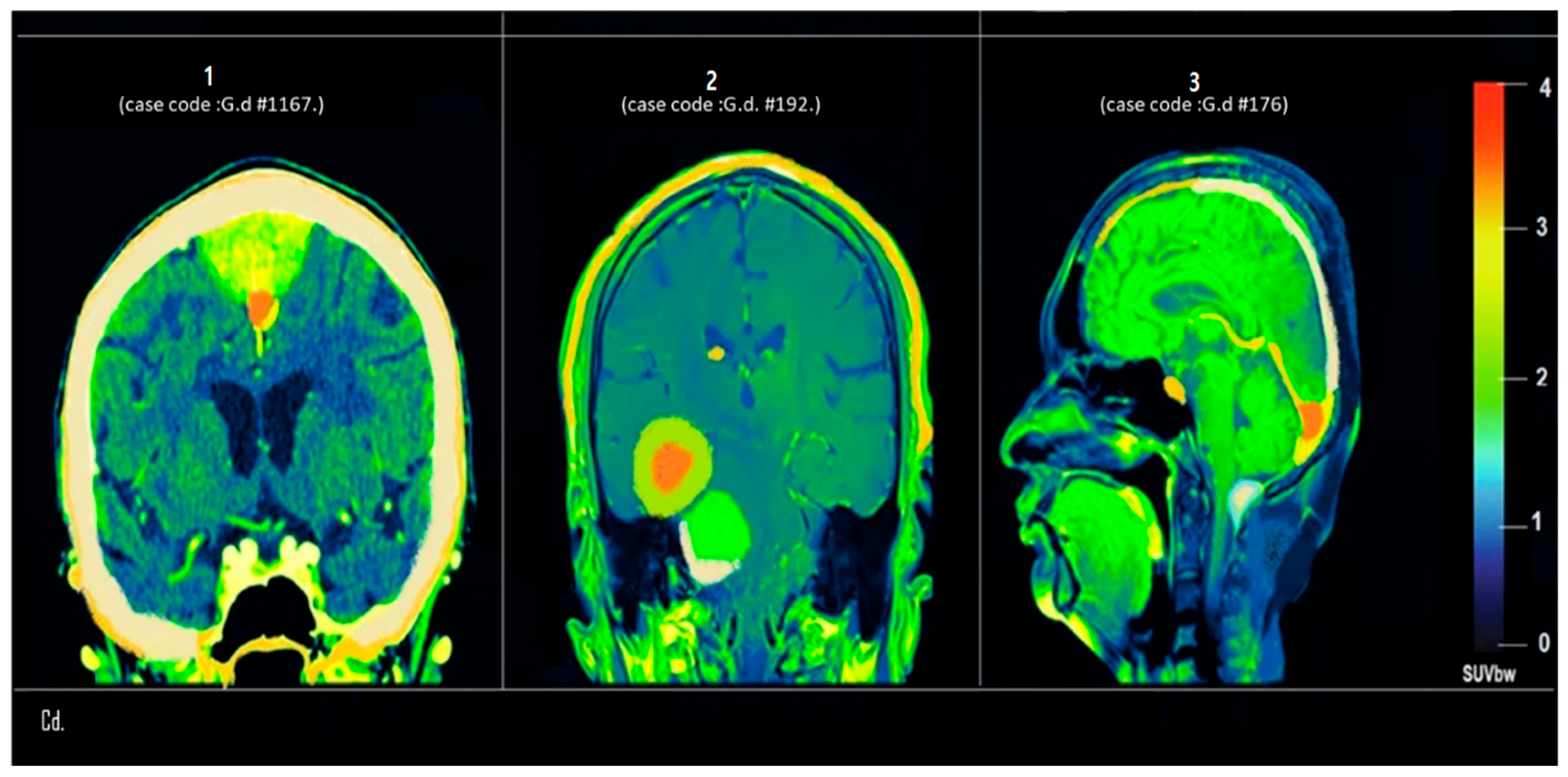 Tomography 12 00020 g005 Tomography 12 00020 g005