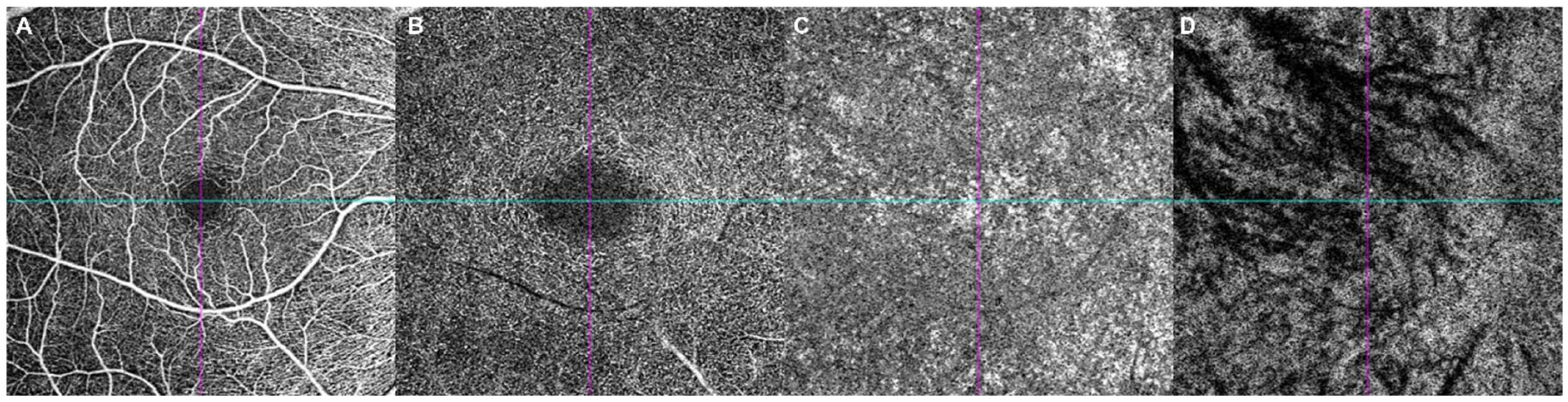Tomography 12 00042 g001 Tomography 12 00042 g001