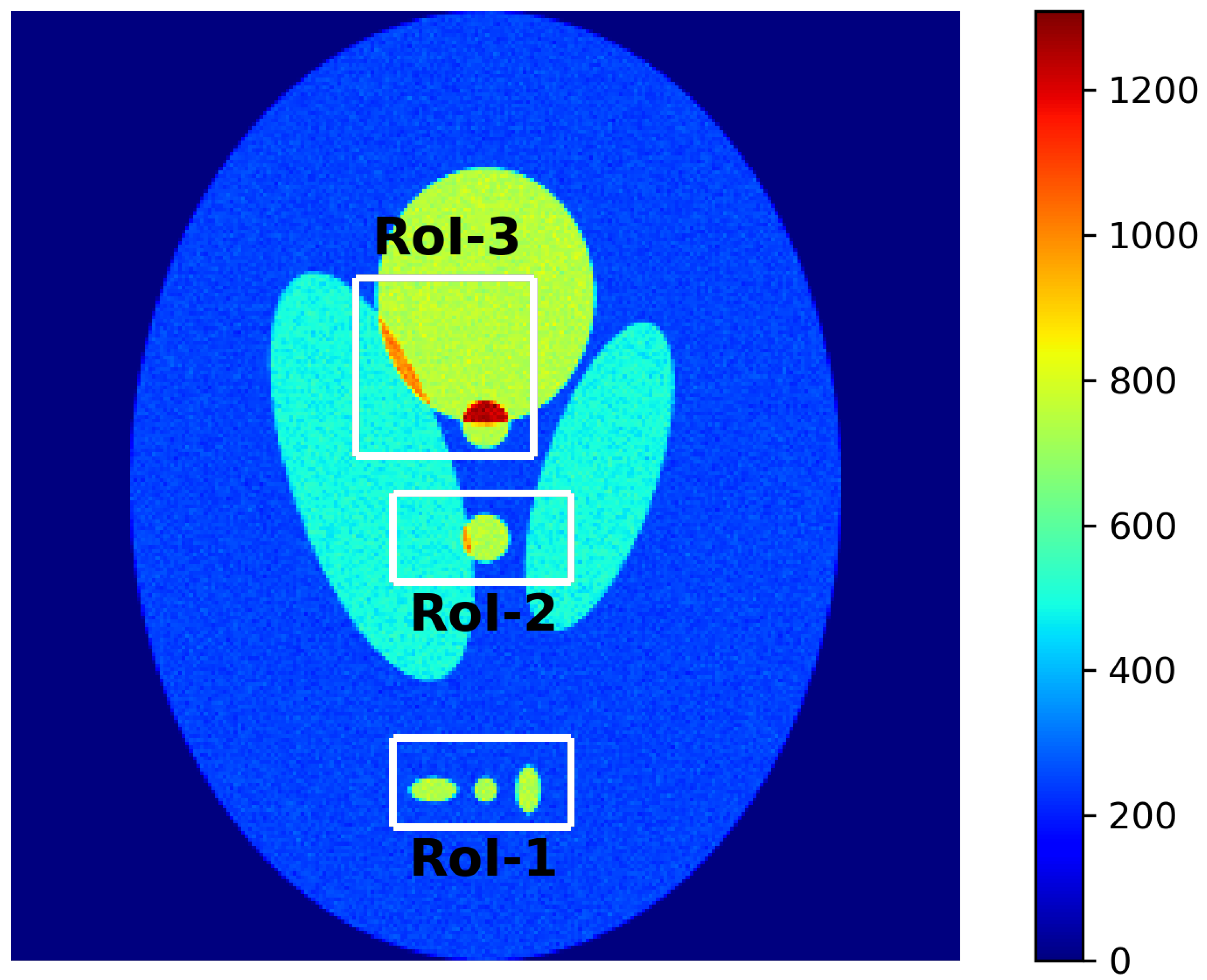 Tomography 12 00049 g001 Tomography 12 00049 g001
