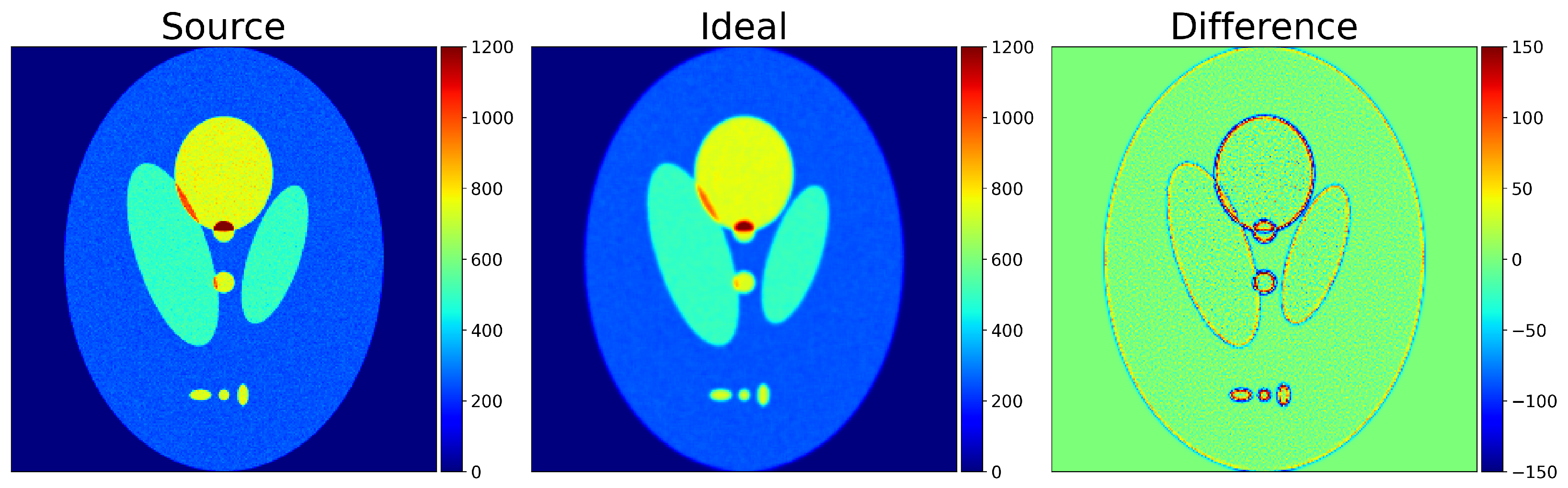 Tomography 12 00049 g003 Tomography 12 00049 g003