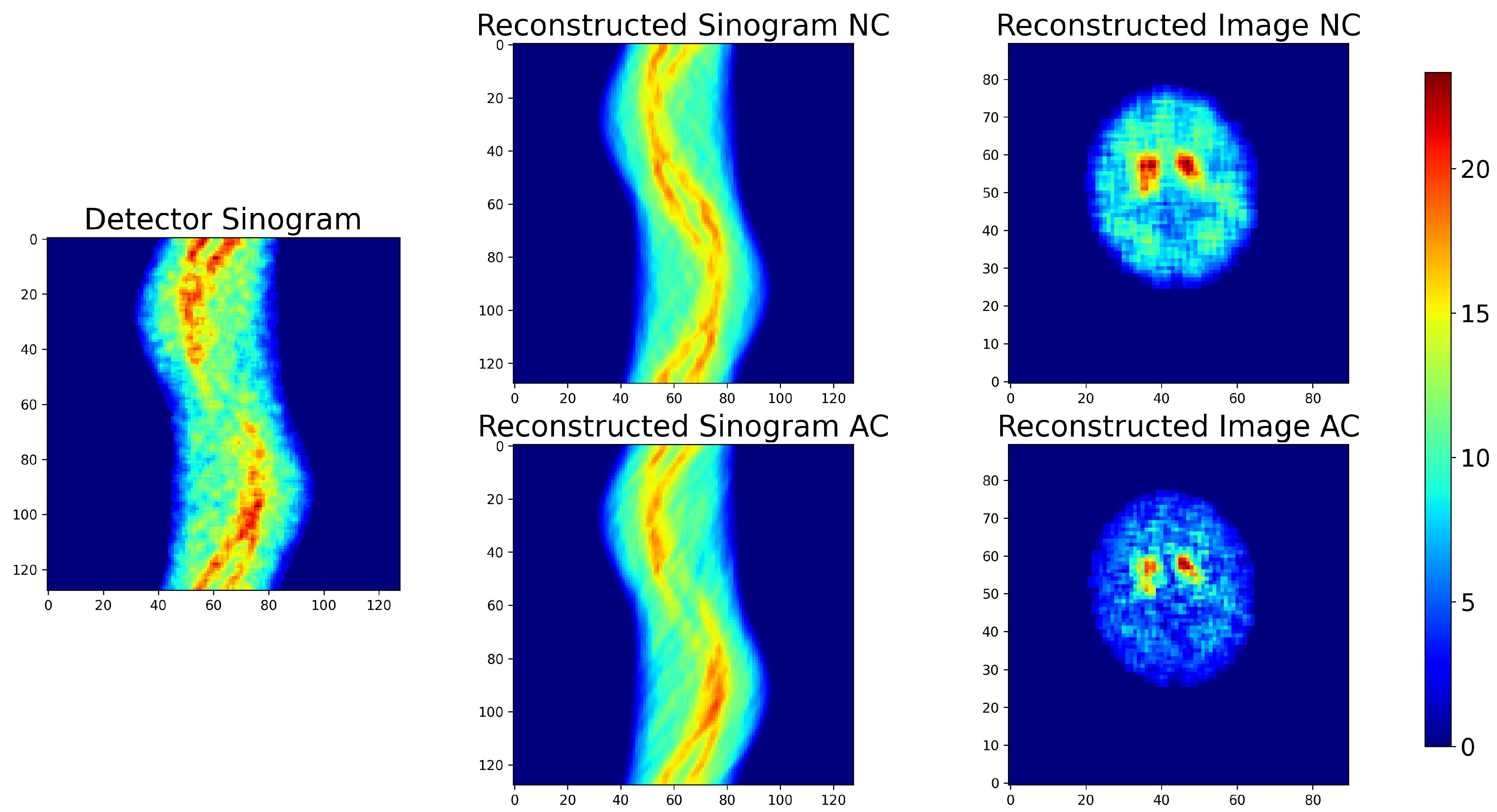 Tomography 12 00049 g018 Tomography 12 00049 g018