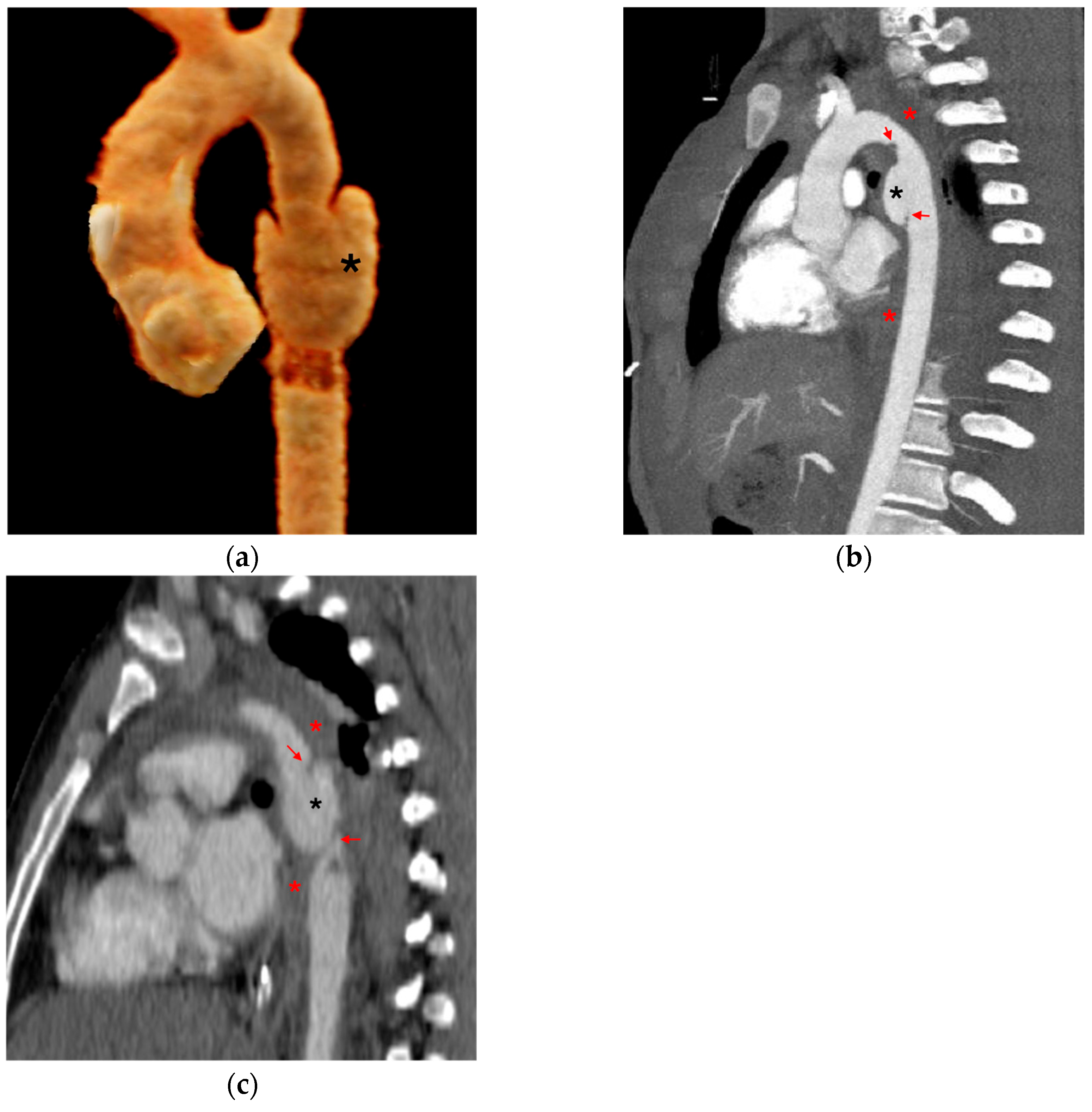 Tomography 12 00057 g004 Tomography 12 00057 g004