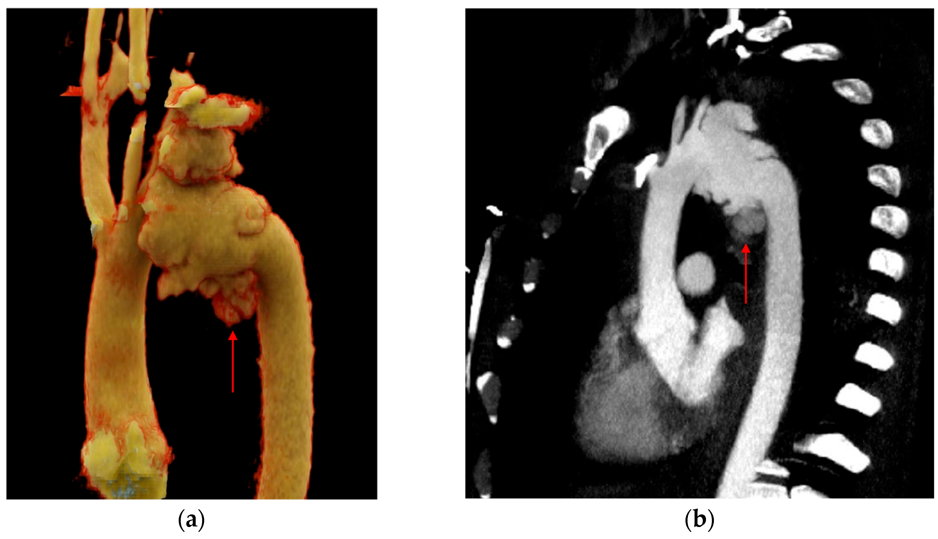 Tomography 12 00057 g005 Tomography 12 00057 g005
