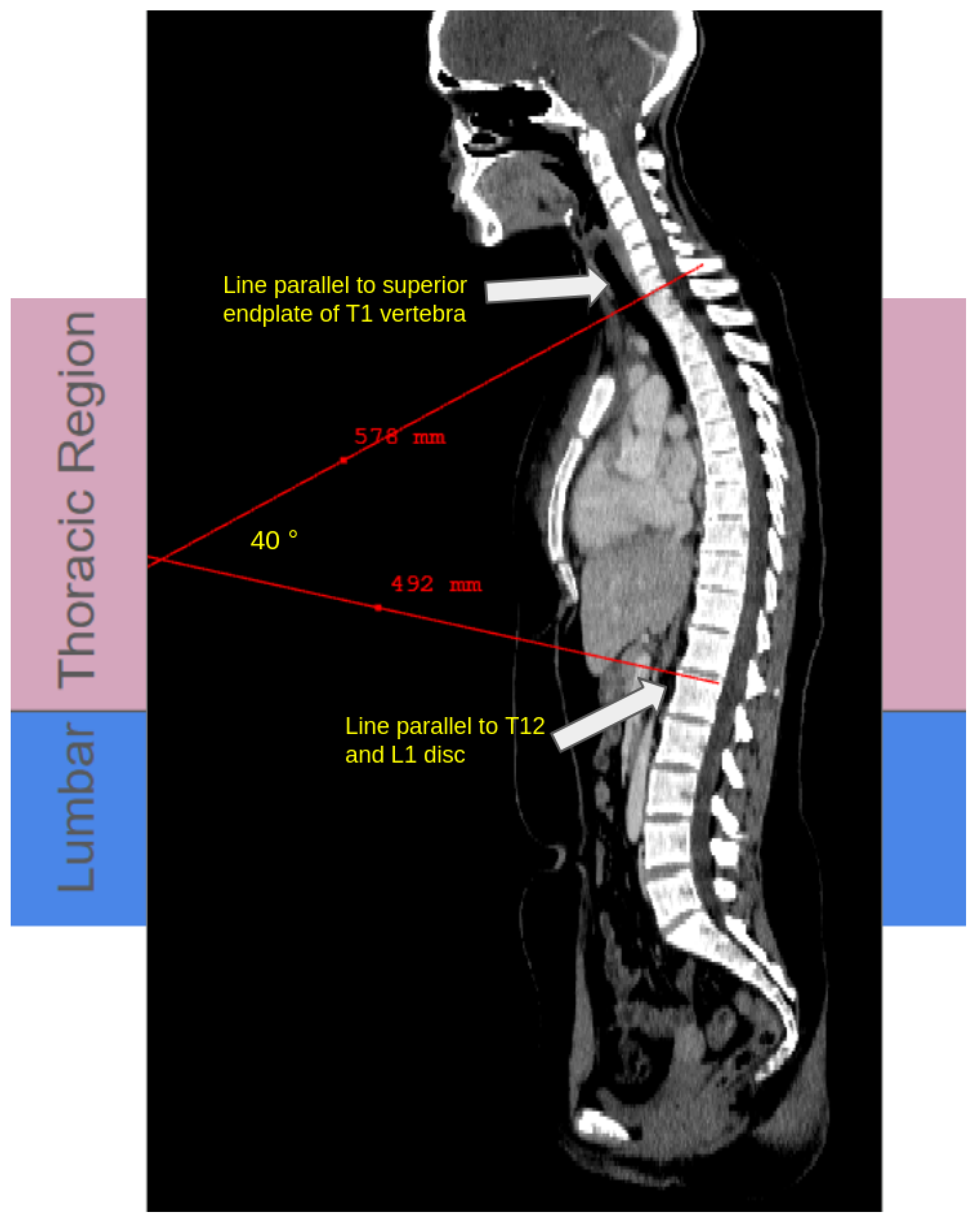Tomography 12 00059 g002 Tomography 12 00059 g002