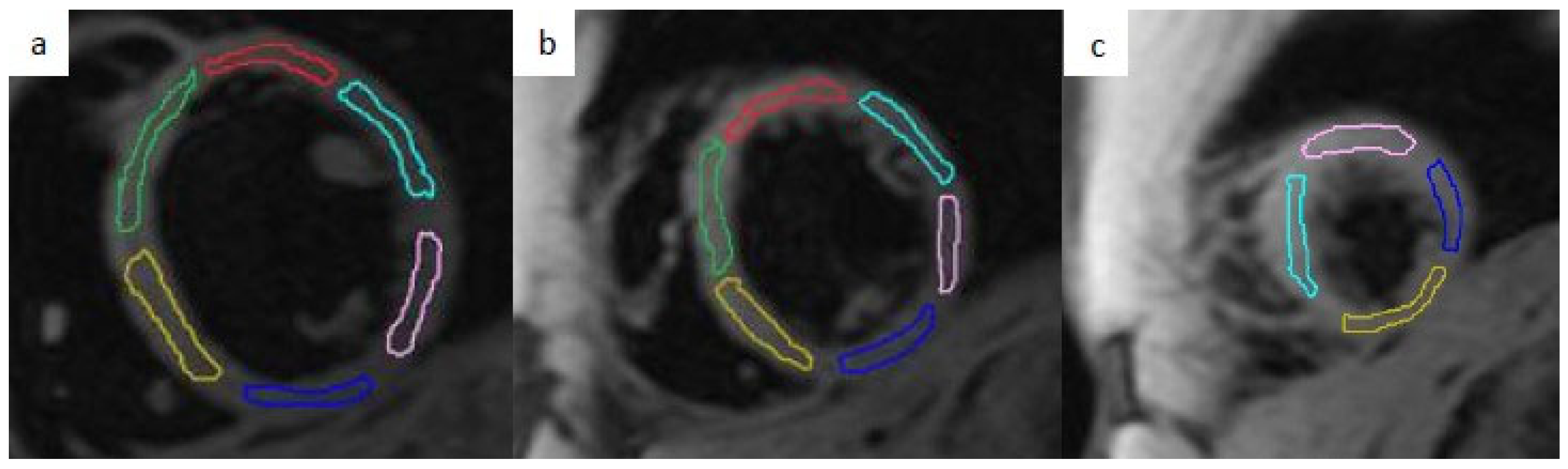 Tomography 12 00075 g001 Tomography 12 00075 g001