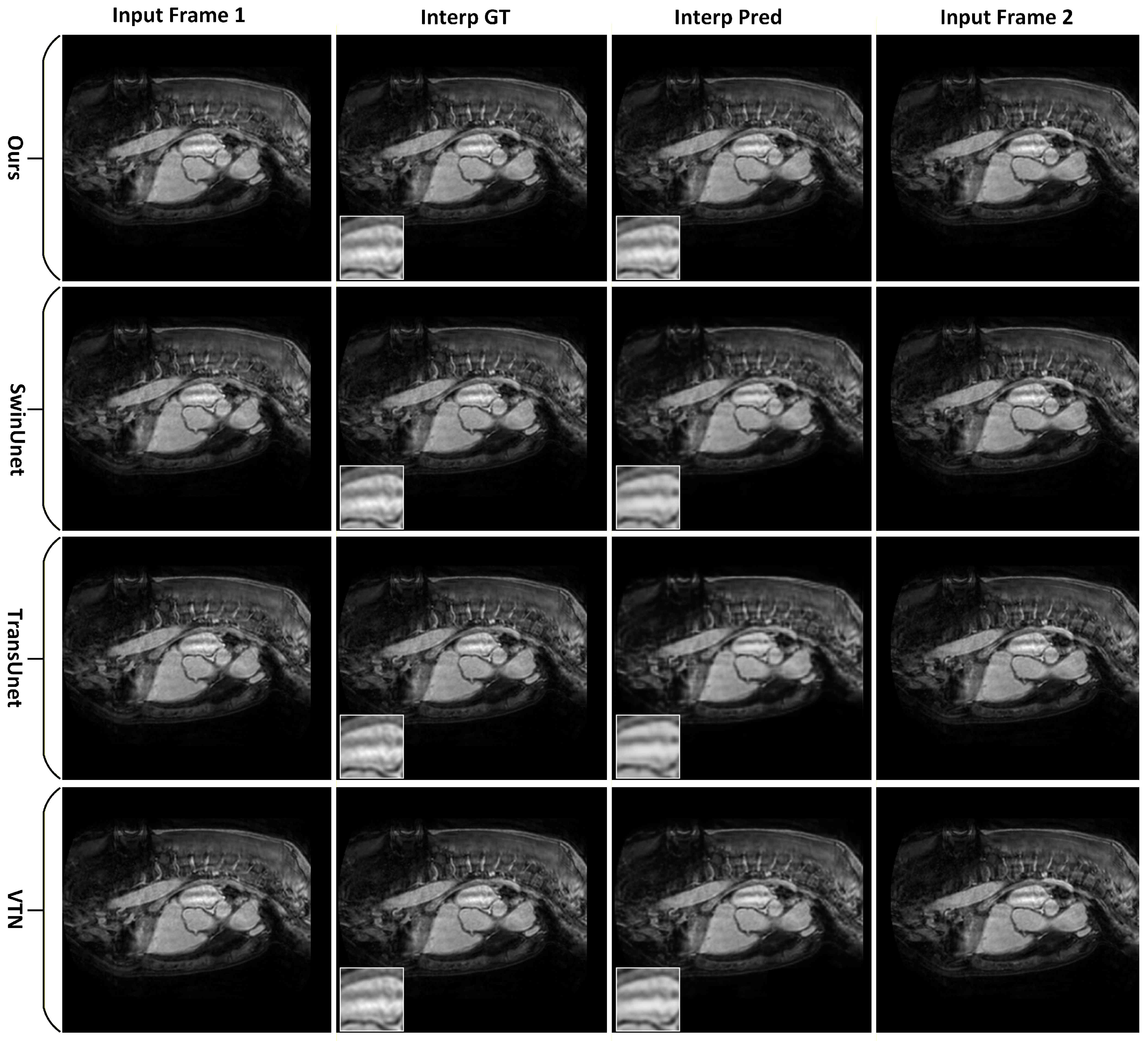 Tomography 12 00080 g007 Tomography 12 00080 g007