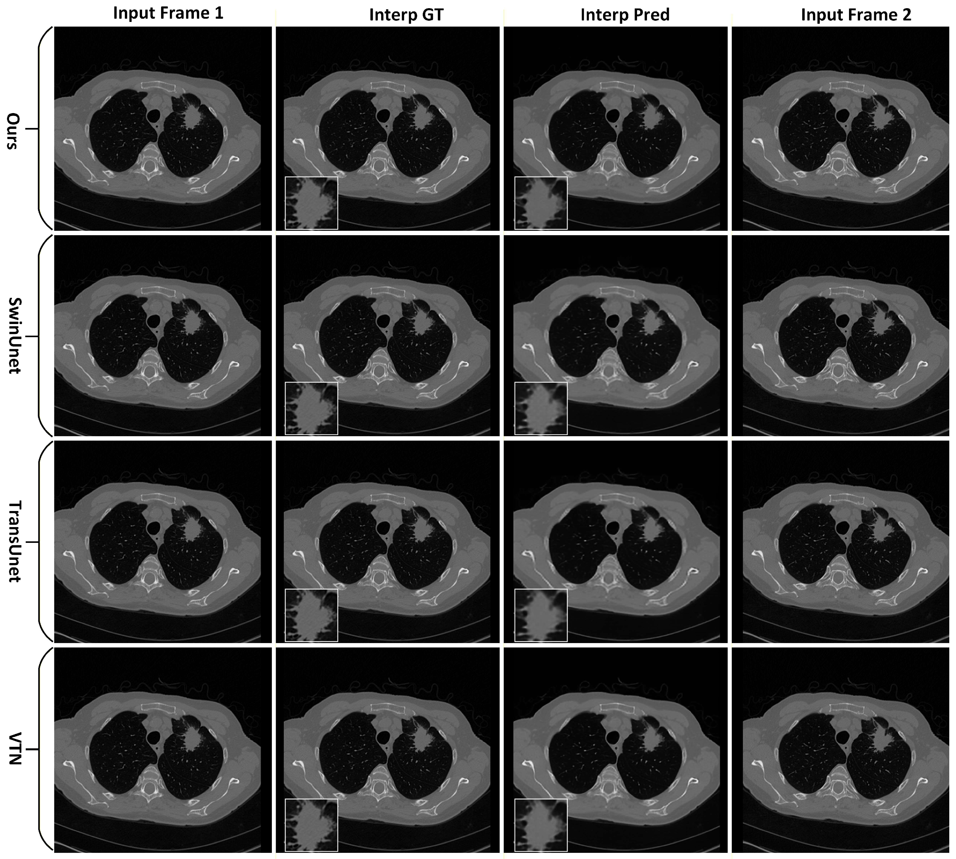 Tomography 12 00080 g009 Tomography 12 00080 g009