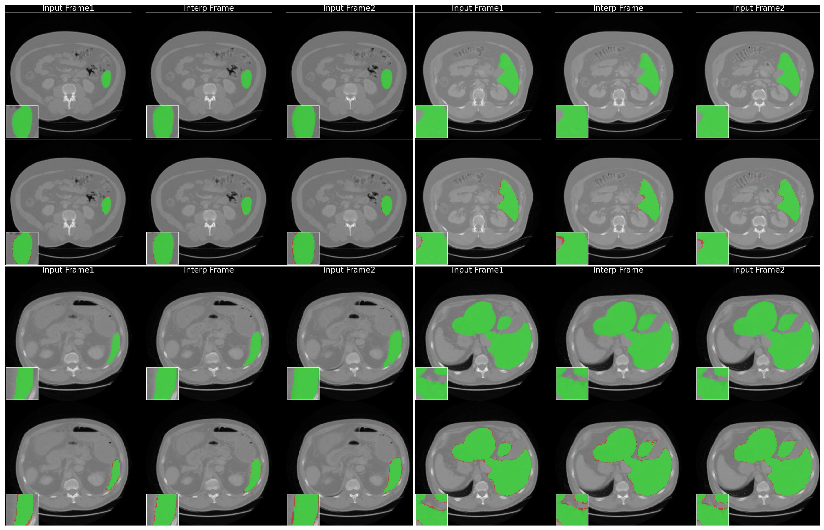 Tomography 12 00080 g017 Tomography 12 00080 g017