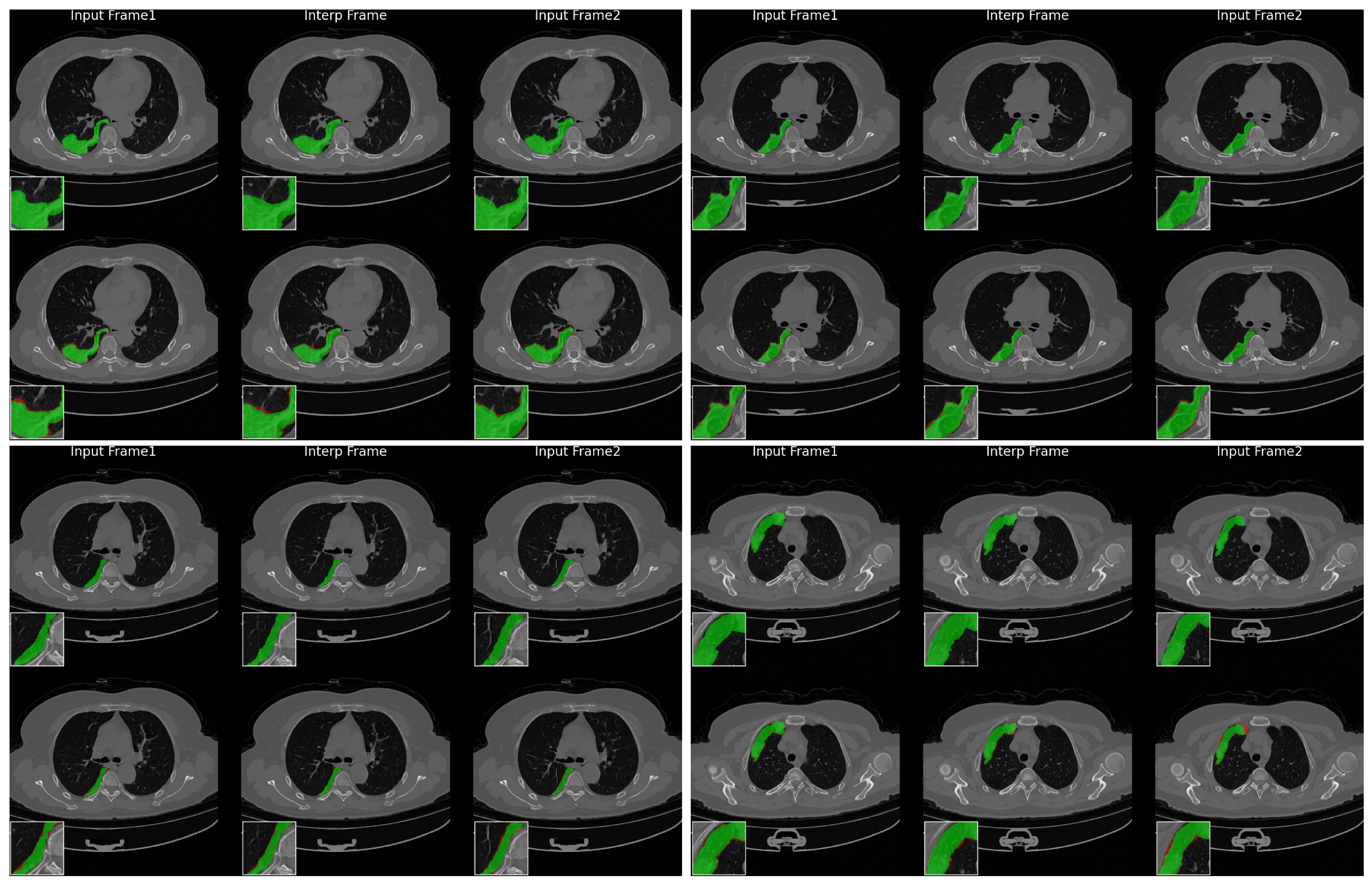 Tomography 12 00080 g019 Tomography 12 00080 g019