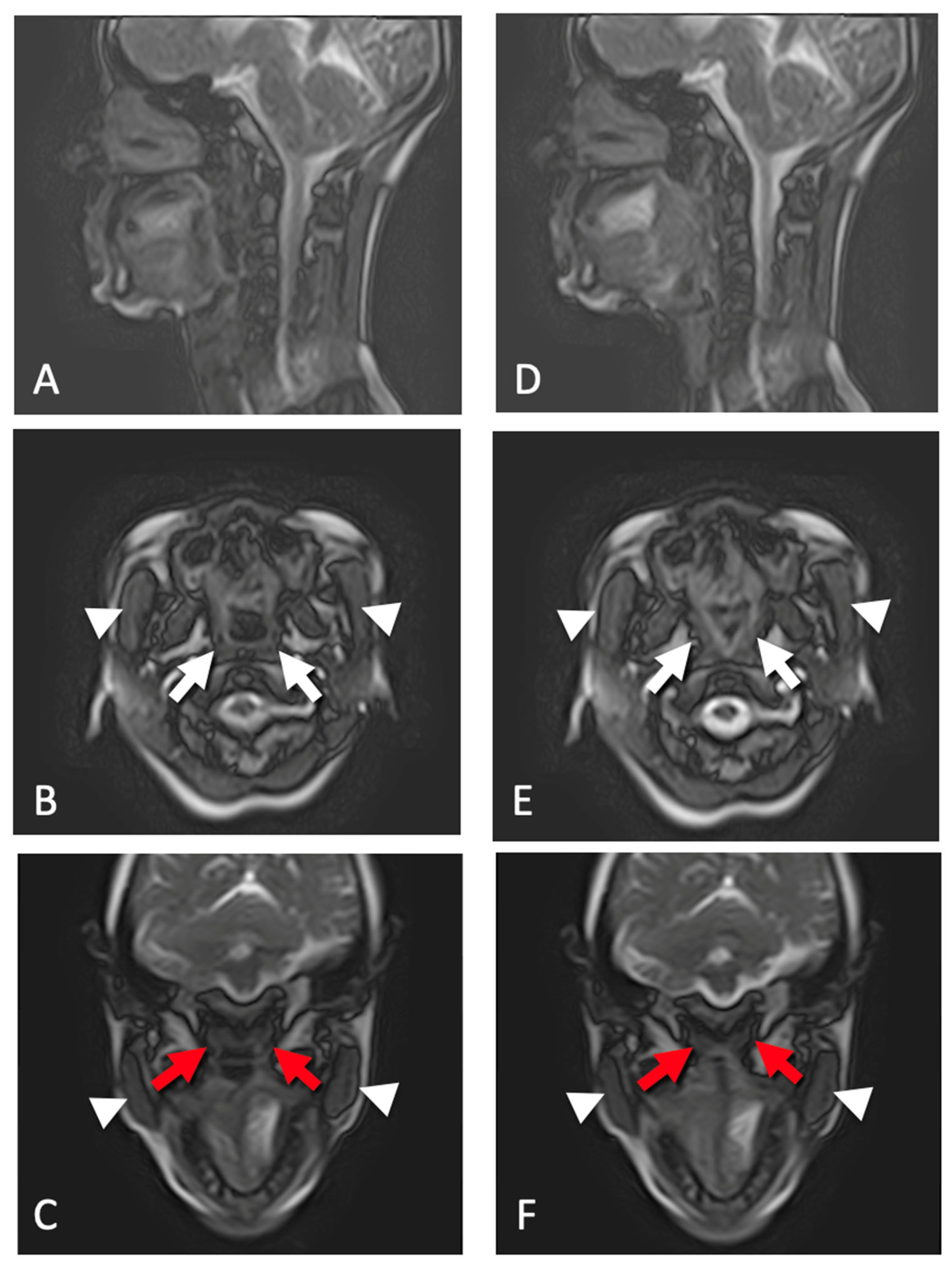 Tomography 12 00117 g003