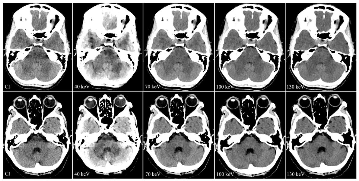 Tomography 12 00120 g009 Tomography 12 00120 g009
