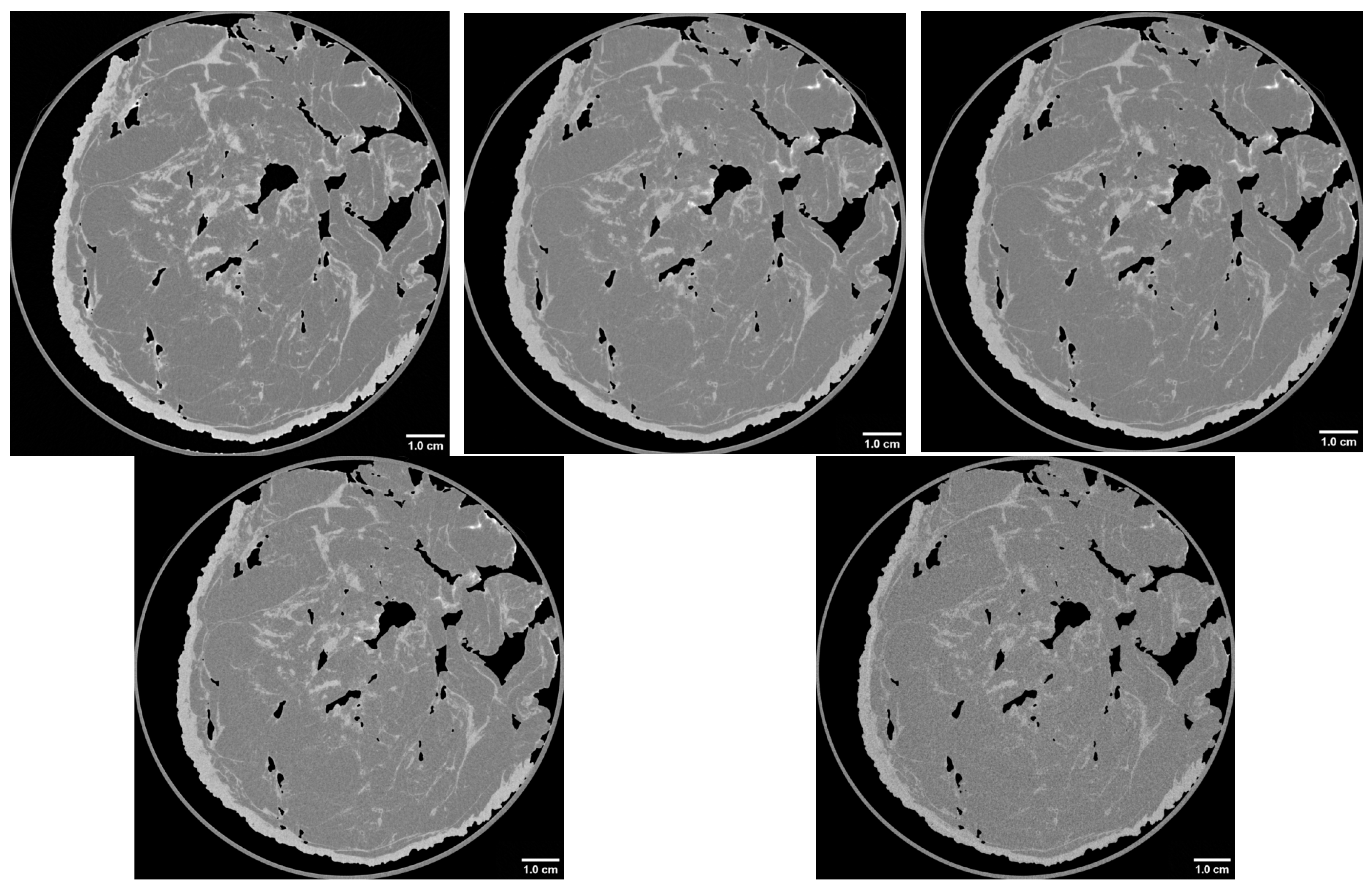 Tomography 12 00124 g002 Tomography 12 00124 g002
