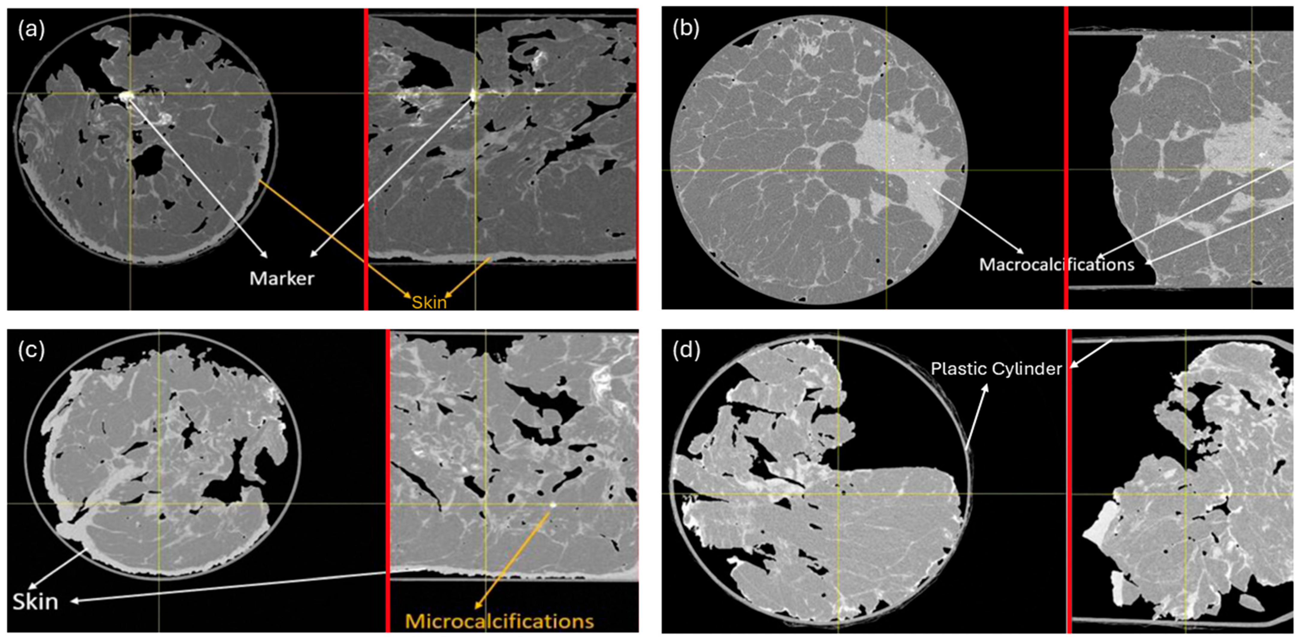 Tomography 12 00124 g003 Tomography 12 00124 g003
