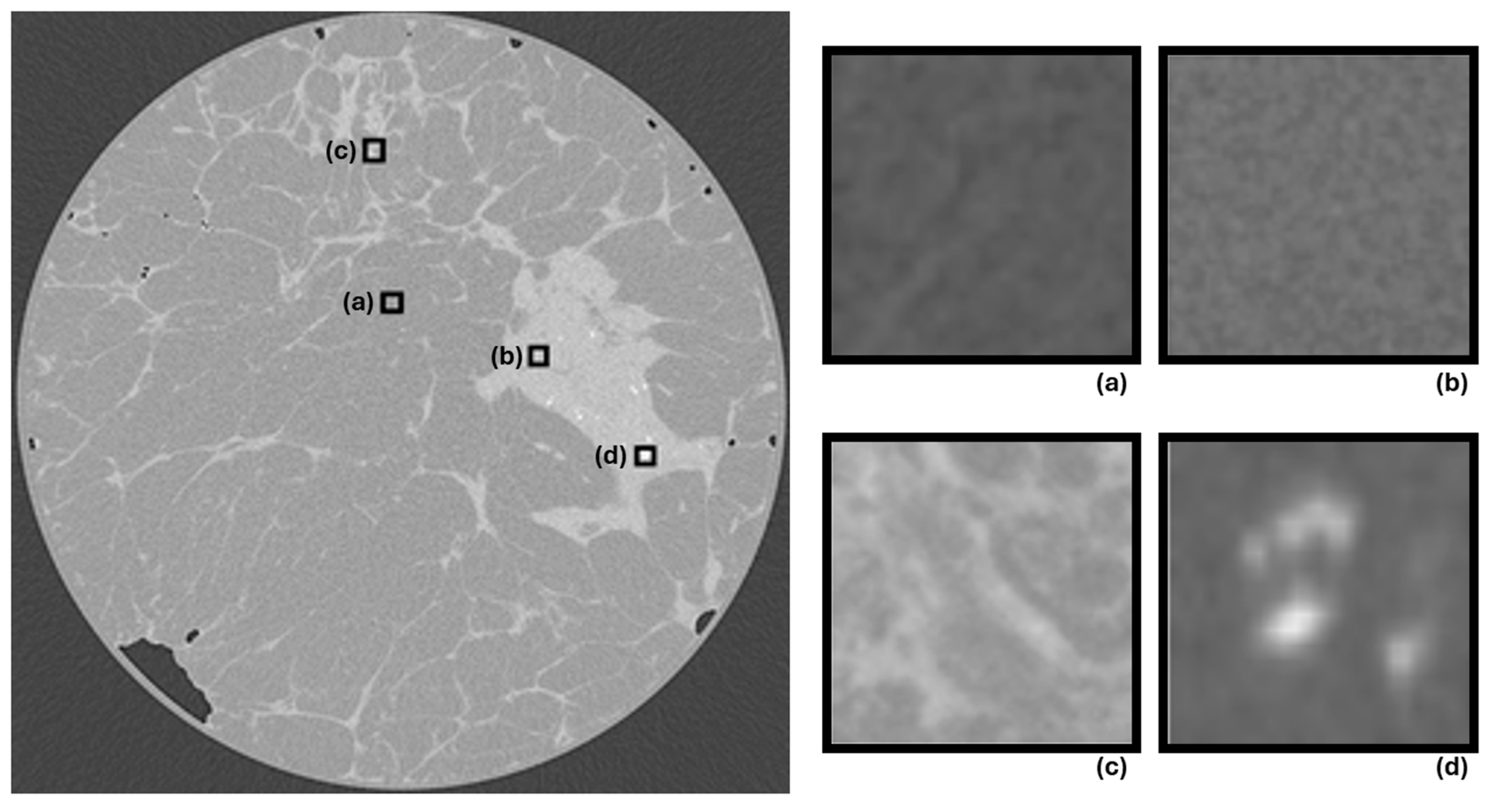 Tomography 12 00124 g004 Tomography 12 00124 g004