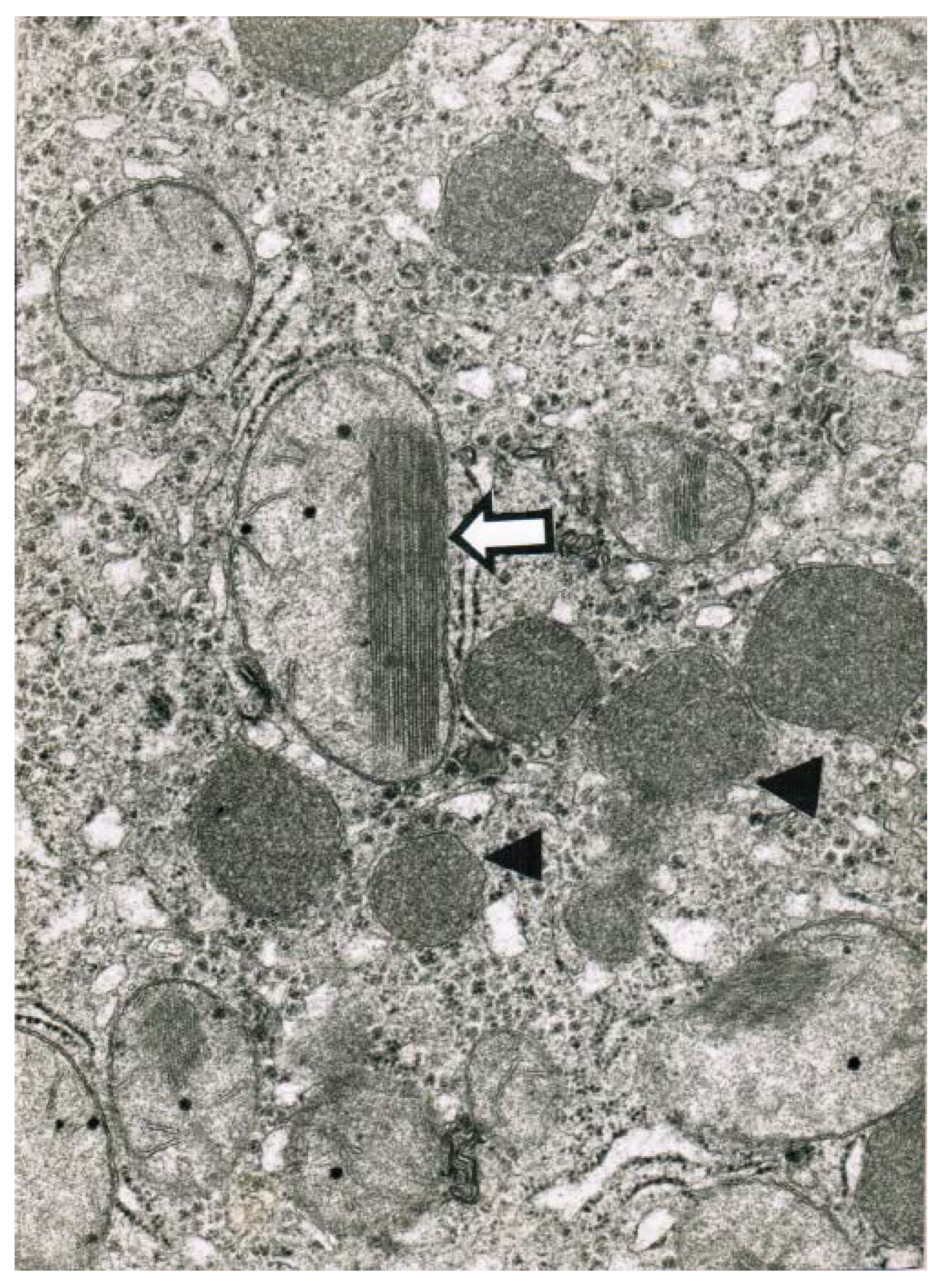 Toxics 06 00025 g008