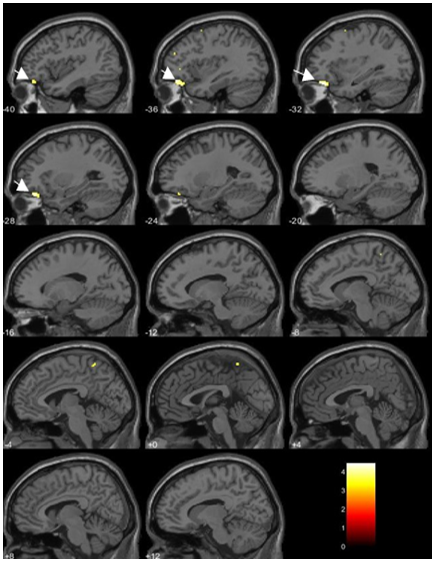 Toxics 09 00353 g004