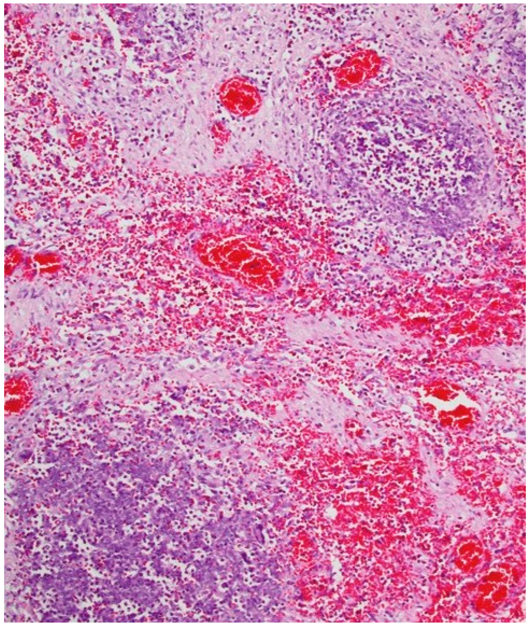 Toxics 10 00166 g003 Toxics 10 00166 g003