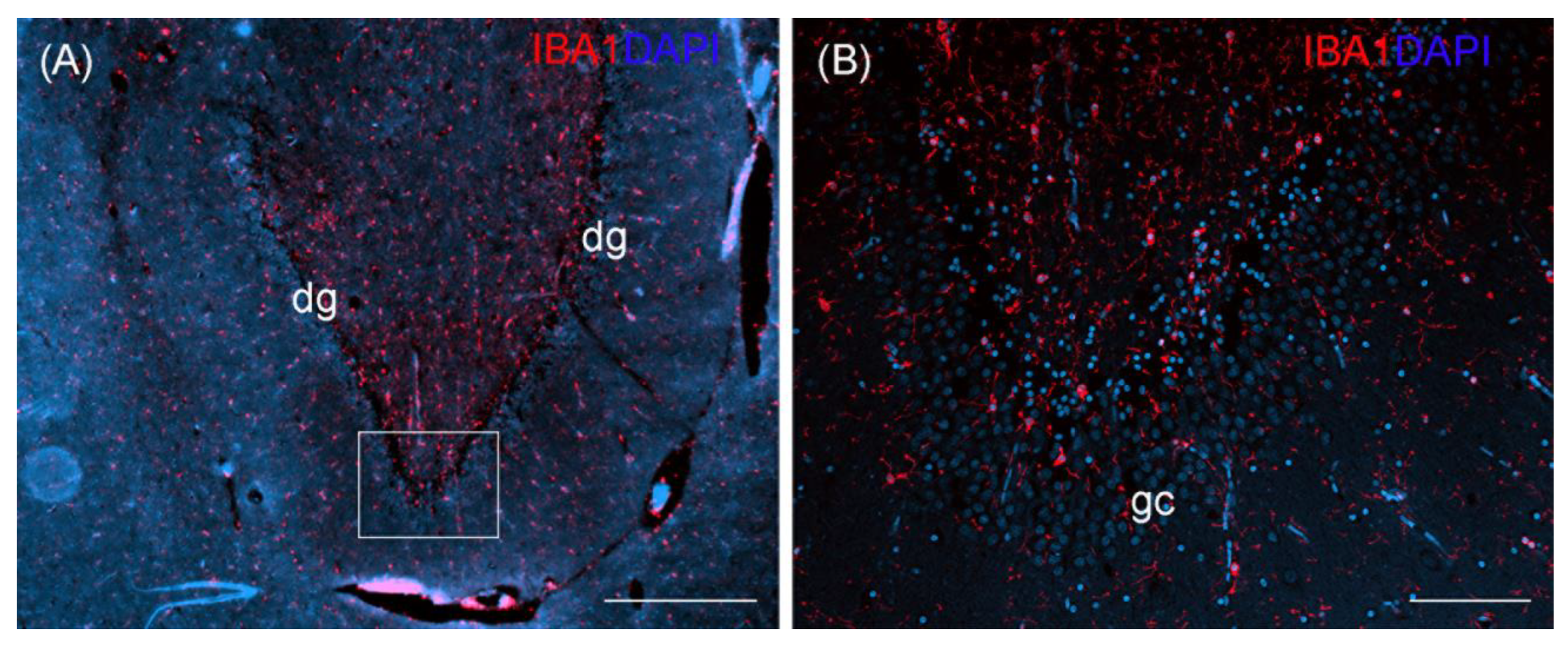 Toxics 11 00338 g004