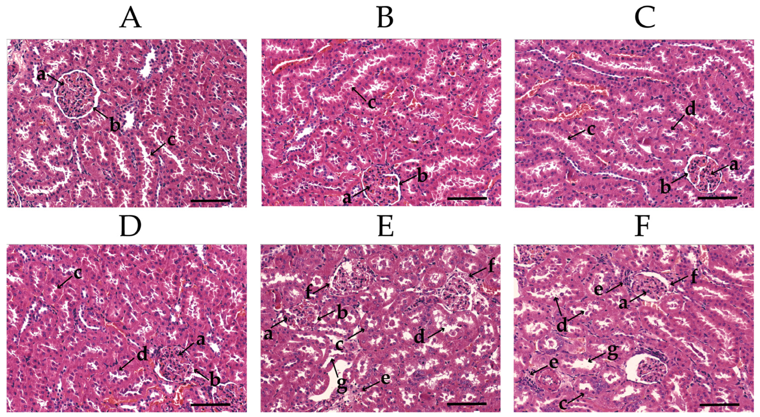 Toxics 11 00479 g003 Toxics 11 00479 g003