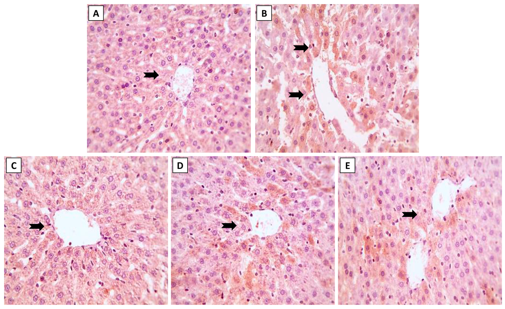 Toxics 11 00784 g005
