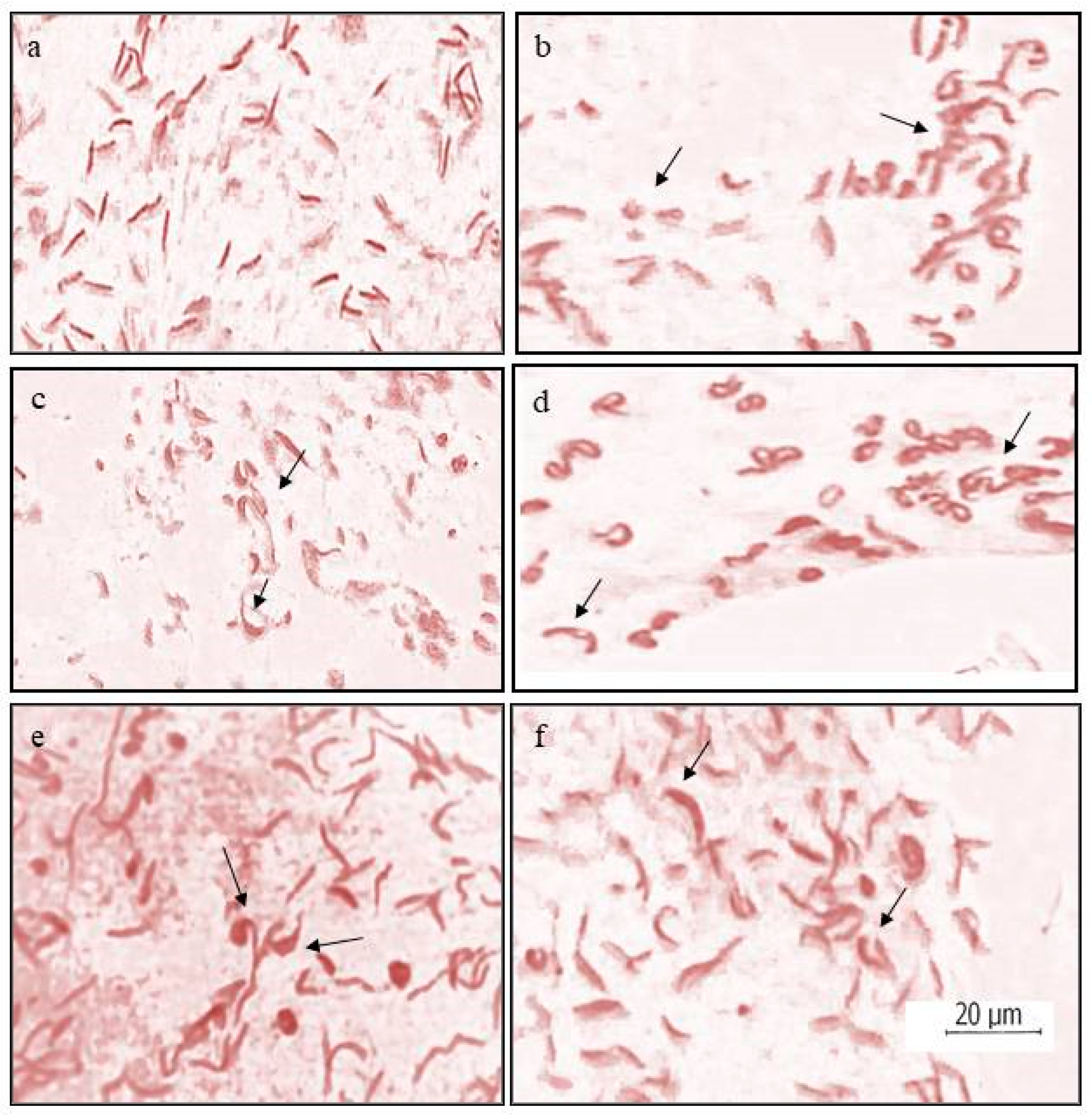 Toxics 11 00887 g004