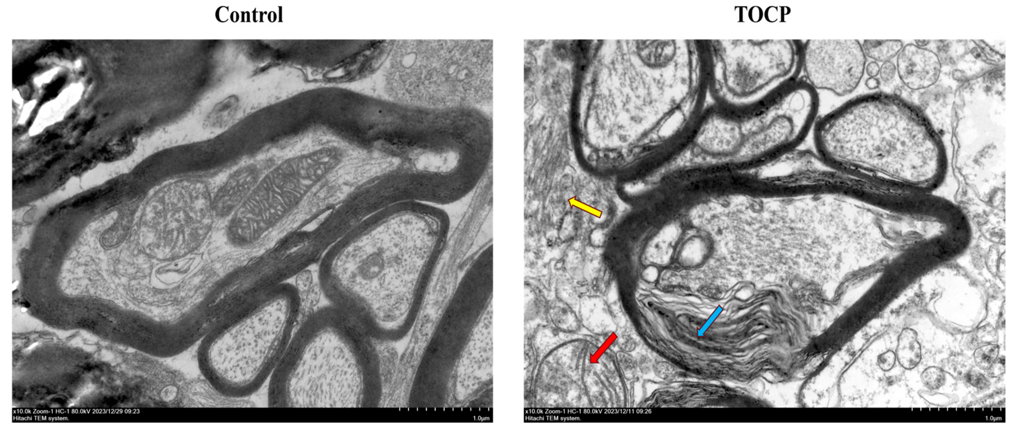 Toxics 12 00810 g003 Toxics 12 00810 g003