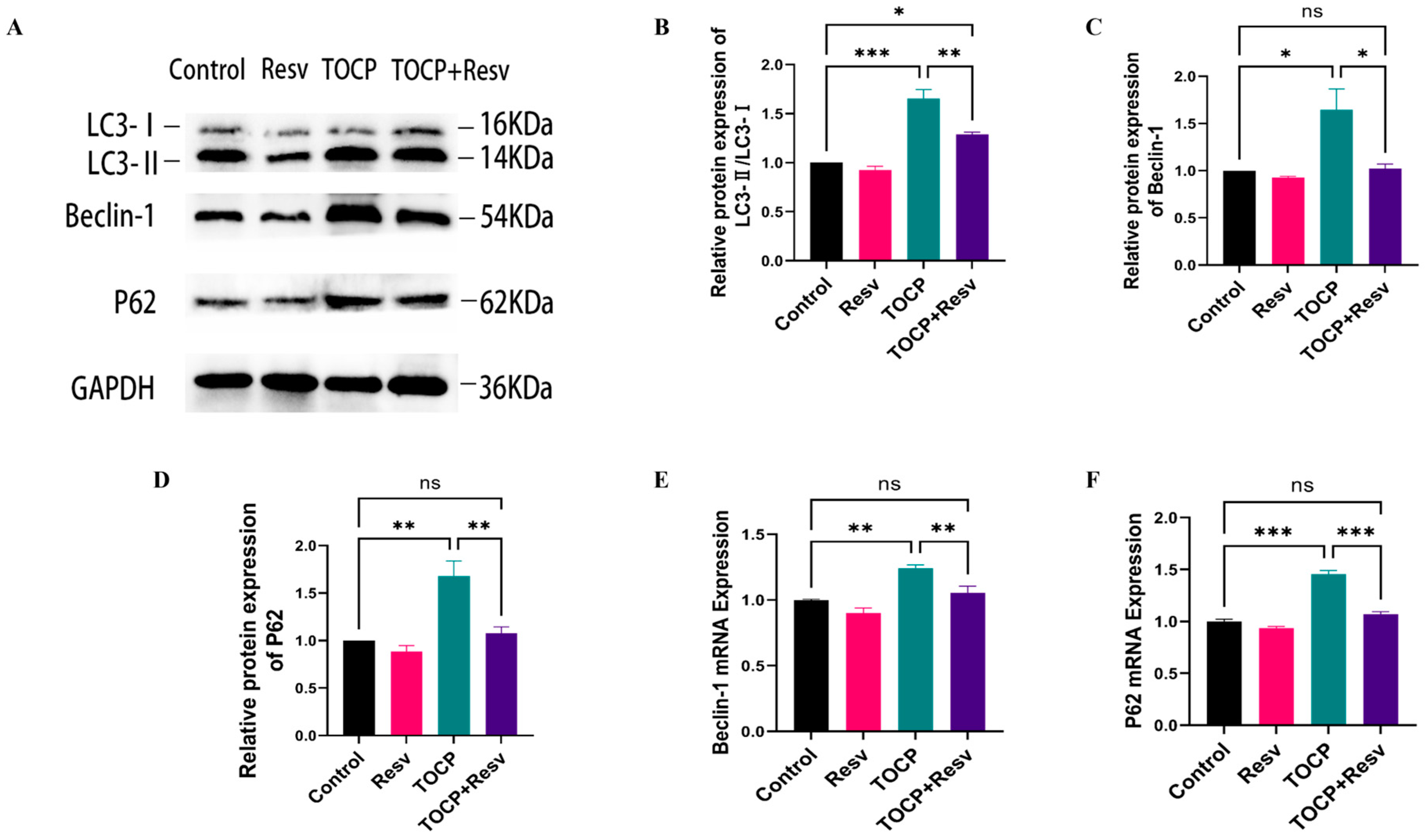 Toxics 12 00810 g007 Toxics 12 00810 g007