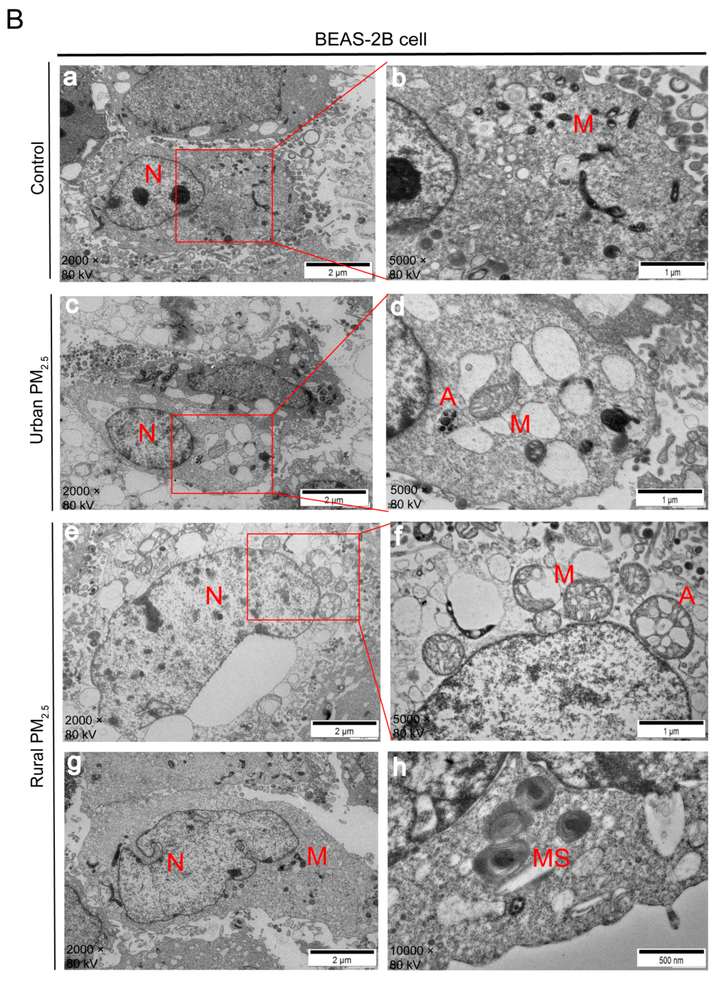 Toxics 14 00531 g002b Toxics 14 00531 g002b
