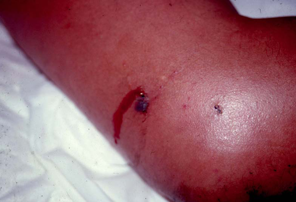 Toxins 02 00163 g002 1024