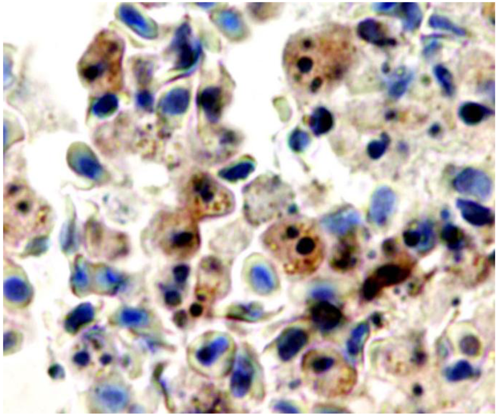 Toxins 02 00905 g003 1024