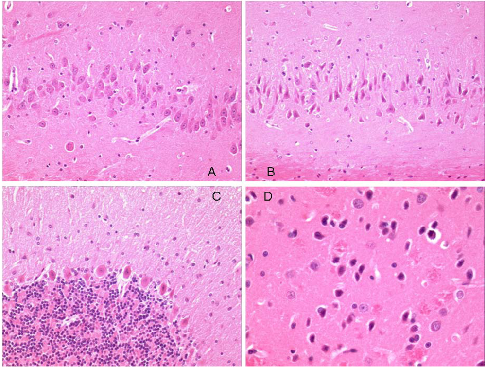Toxins 02 01100 g005 1024