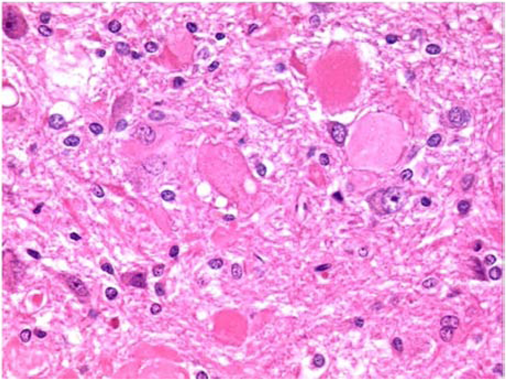 Toxins 02 01100 g007 1024